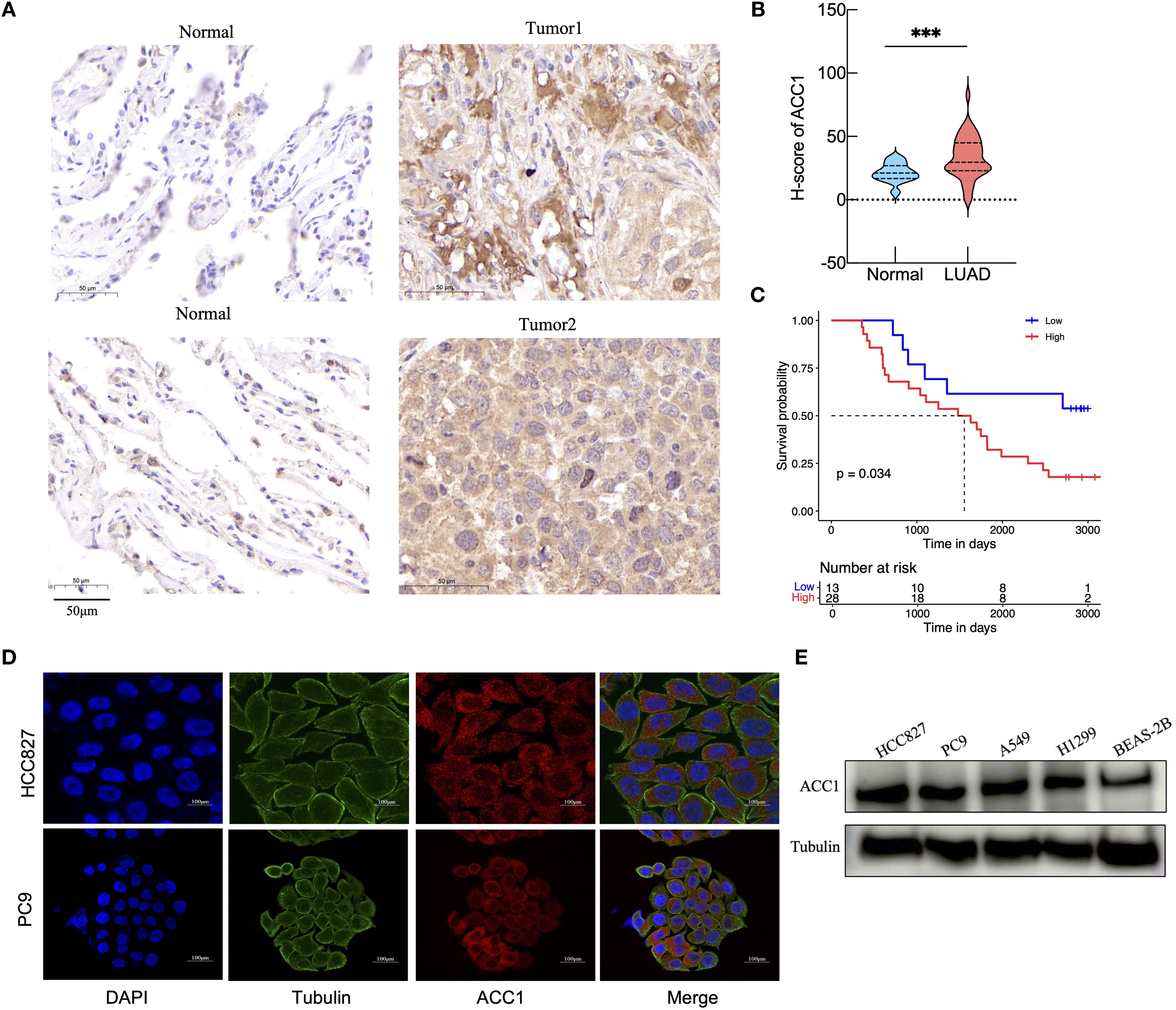 Panel A shows immunohistochemical staining comparing normal and tumor tissues, highlighting ACC1 expression. Panel B presents a violin plot comparing ACC1 H-scores between normal and LUAD samples with significant difference noted. Panel C is a Kaplan-Meier survival curve showing survival probabilities for low and high ACC1 expression, with significant difference (p=0.034). Panel D displays immunofluorescence images of HCC827 and PC9 cells stained for DAPI, tubulin, and ACC1, with merged images illustrating localization. Panel E shows a Western blot analysis comparing ACC1 and tubulin protein levels across different cell lines.