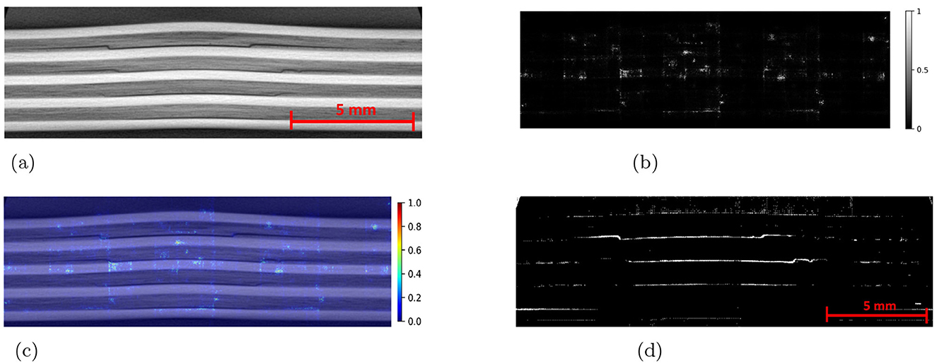 (a) CT slice showing layers impacted by 7.5 Joules, marked with a 5 mm scale. (b) Grayscale attribution map. (c) Attribution map overlaid on a CT slice, with a colored scale from 0 to 1. (d) Predicted mask with highlighted lines and a 5 mm scale.