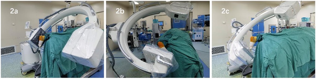 Three images labeled 2a, 2b, and 2c show a C-arm X-ray machine positioned at different angles over a patient covered in green drapes in an operating room. Each angle shows the machine's arm and imaging panel from different perspectives.