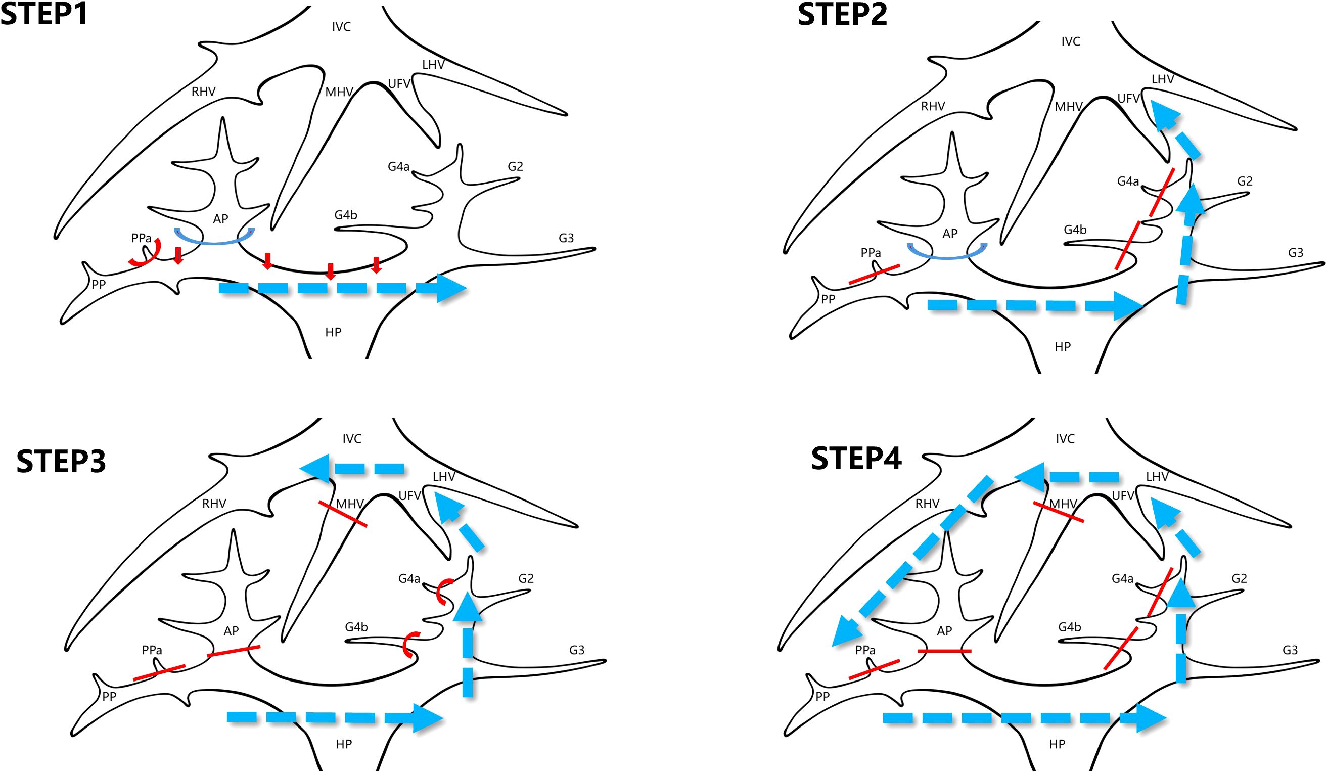 Diagram showing four sequential steps of a procedure, labeled Step 1 to Step 4. Each step illustrates changes in lines and arrows representing pathways and connections, with labels such as RHV, LHV, MHV, UFV, and AP. Blue arrows show progression and direction, and red lines highlight specific pathways.