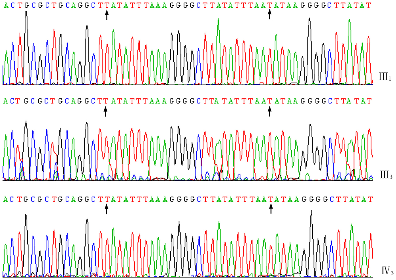 DNA sequencing chromatograms showing nucleotide sequences for three different samples labeled III1, III3, and IV3. Arrows indicate specific sequence variations.