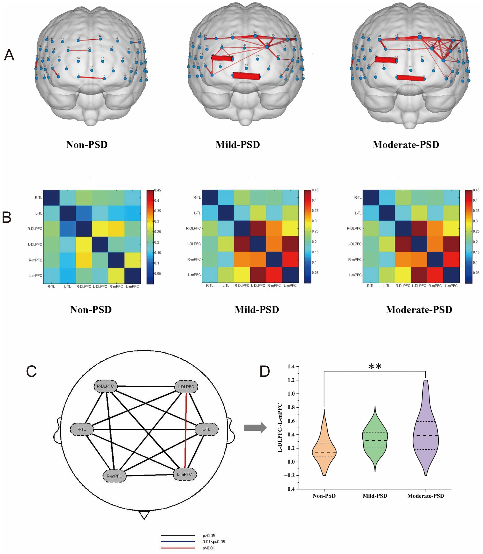 Panel A shows brain connectivity diagrams for Non-PSD, Mild-PSD, and Moderate-PSD with thicker red lines indicating stronger connectivity. Panel B displays corresponding matrix graphs illustrating connectivity strengths. Panel C shows a simplified brain diagram with connections marked by lines, differentiated by significance levels. Panel D presents a violin plot comparing LDLPFC-LMPFC connectivity across Non-PSD, Mild-PSD, and Moderate-PSD, with significant differences indicated by asterisks.