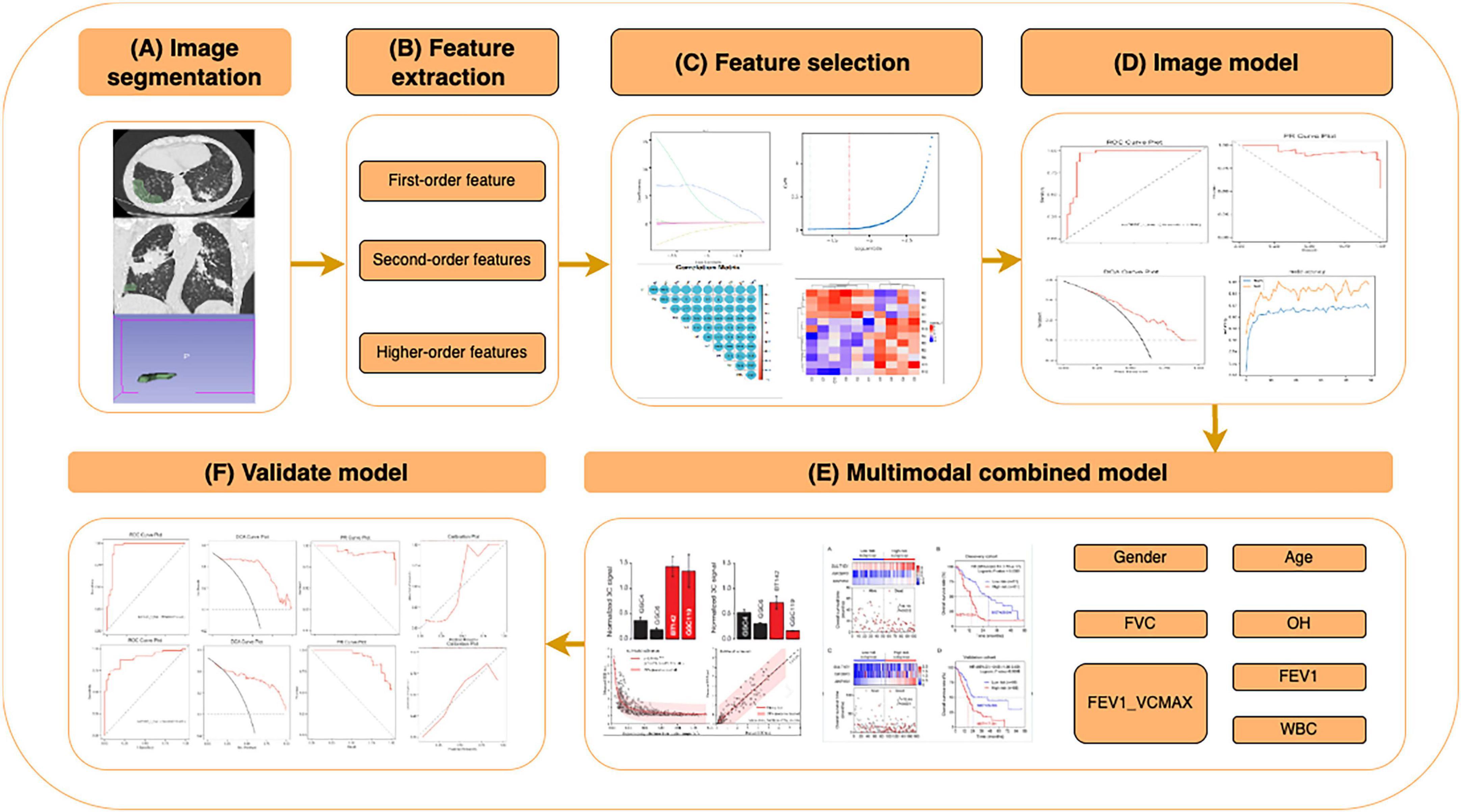 Flowchart illustrating a process for model development with six steps: (A) Image segmentation, showing lung scans. (B) Feature extraction, listing first, second, and higher-order features. (C) Feature selection, with graphs and heatmaps. (D) Image model, displaying performance plots. (E) Multimodal combined model, with additional variables like gender, age, and medical metrics. (F) Model validation, showcasing performance charts.
