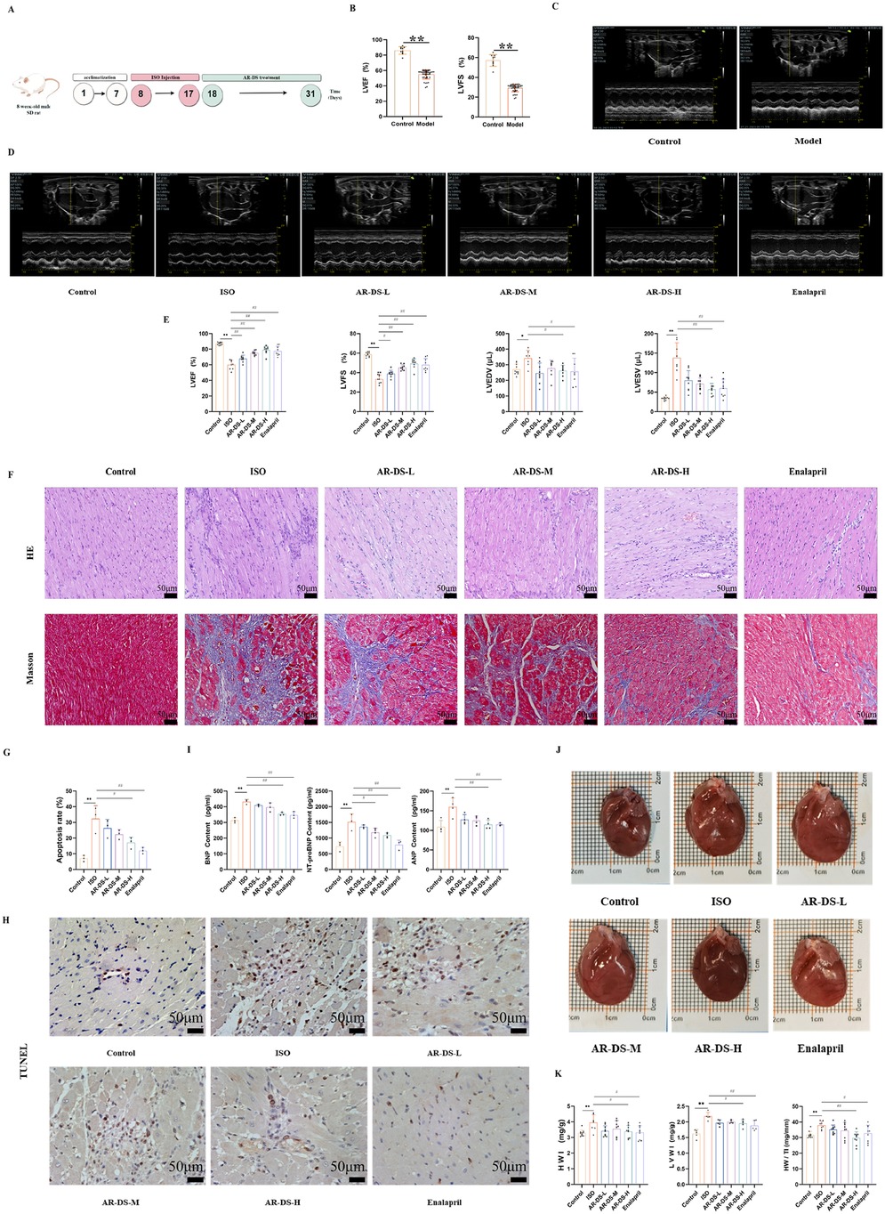 Illustration depicting a study on cardiac treatment effectiveness in mice. Panel A shows the experimental timeline. Panel B presents bar graphs comparing cardiac function in control and model groups. Panel C displays echocardiograph images of control and model hearts. Panel D offers echocardiograph comparisons across various treatments, including ISO and AR-DS variants. Panel E features bar graphs evaluating cardiac metrics across treatments. Panel F exhibits histological heart tissue images under H&E and Masson staining. Panel G provides an apoptosis rate bar graph. Panel H illustrates TUNEL staining images. Panel I contains bar graphs for stress-related responses. Panel J shows heart images post-treatment with size comparisons. Panel K displays additional cardiac function bar graphs.