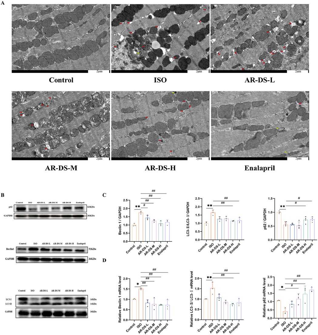 Panel A shows electron micrographs of myocardial tissue under different treatments: Control, ISO, AR-DS-L, AR-DS-M, AR-DS-H, and Enalapril. Panel B displays Western blots for proteins p62, Beclin1, and LC3-I/II, with GAPDH as a loading control. Panels C and D present graphs indicating relative protein and mRNA levels, respectively, for Beclin1, LC3-I/II, and p62, comparing different treatments with statistical annotations. Scale bars and color indicators are present in micrographs for visual clarity.