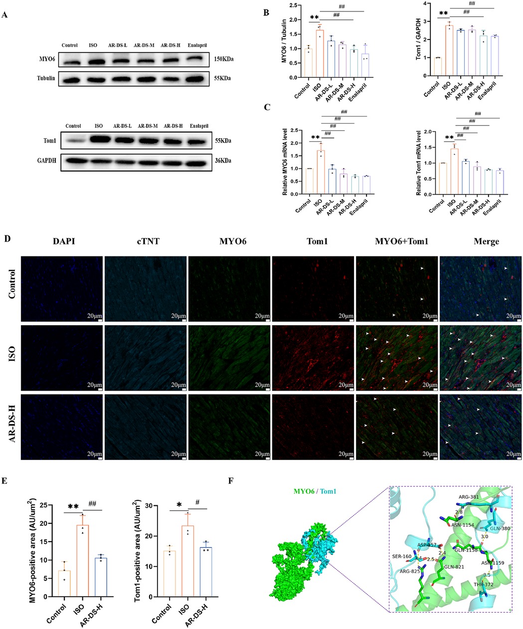 Western blot results show MYO6 and Tom1 protein expressions under different conditions, with corresponding graphs comparing protein levels. Immunofluorescence images display control, ISO, and AR-DS-H treatments, highlighting MYO6 and Tom1 co-localization. Quantitative graphs for MYO6 and Tom1 positive areas are included. A molecular structure depicts the interaction between MYO6 and Tom1.