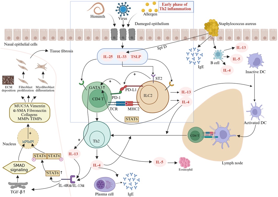 Schematic illustration of the type 2 inflammatory cascade in CRSwNP: Nasal epithelial cells release alarmins (IL-25, IL-33, TSLP) upon stimulation, activating ILC2s to produce IL-4. IL-4 activates the STAT6 pathway and upregulates GATA3, amplifying transcription of IL-4, IL-5, and IL-13. IL-13 promotes dendritic cell migration to lymph nodes, priming naive CD4+ T cells into Th2 cells. Th2-derived cytokines drive IgE production, eosinophil activation, and tissue remodeling. The PD-1/PD-L1 axis on ILC2s and Th2 cells forms a positive feedback loop to enhance IL-13 release and Th2 differentiation.
