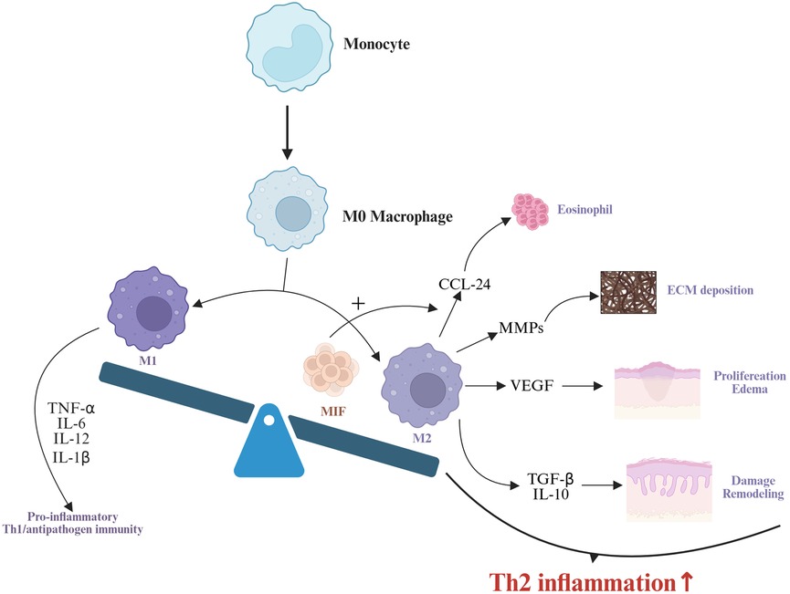 Diagram depicting the role of M2 macrophages in type 2 CRSwNP: Monocytes differentiate into M0 macrophages, which polarize to M2 phenotype. M2 macrophages secrete CCL-24 to recruit eosinophils, MMPs for ECM deposition, and VEGF to promote epithelial hyperplasia and polyp edema. MIF enhances M2 polarization, while TGF-ß and IL-10 drive nasal mucosal remodeling. These mechanisms collectively amplify type 2 inflammatory responses.