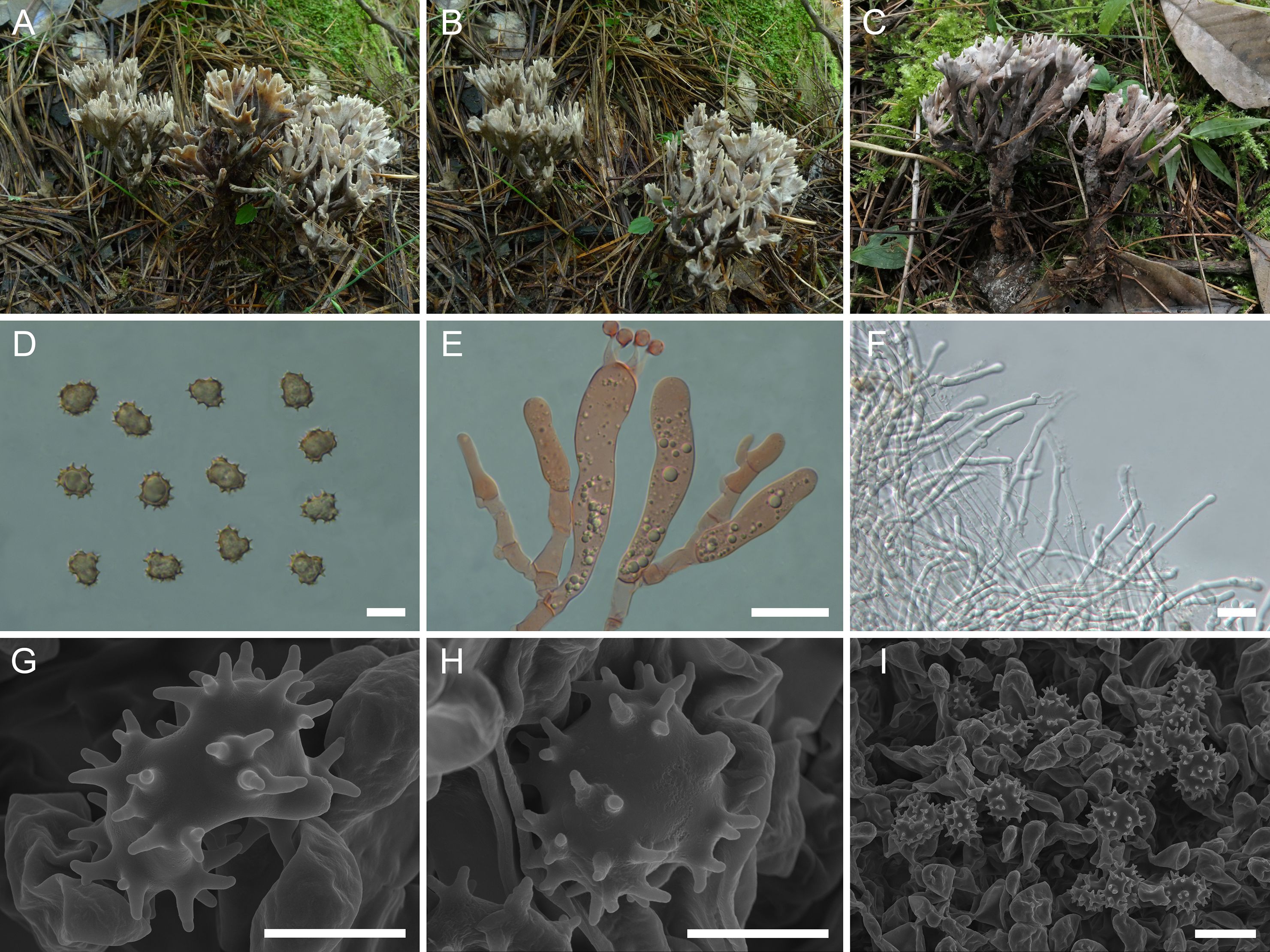 A collage of images labeled A to I. A-C show clusters of fungi with white to brownish hues growing on a forest floor among pine needles and moss. D presents a grid of small, spiked spores. E depicts a microscopic view of hyphal structures with rounded ends. F shows a cluster of thin, branching filaments. G-H are electron microscope images of spiked spores with detailed surface textures. I displays a dense cluster of spores under an electron microscope. Each image has a scale bar for size reference.