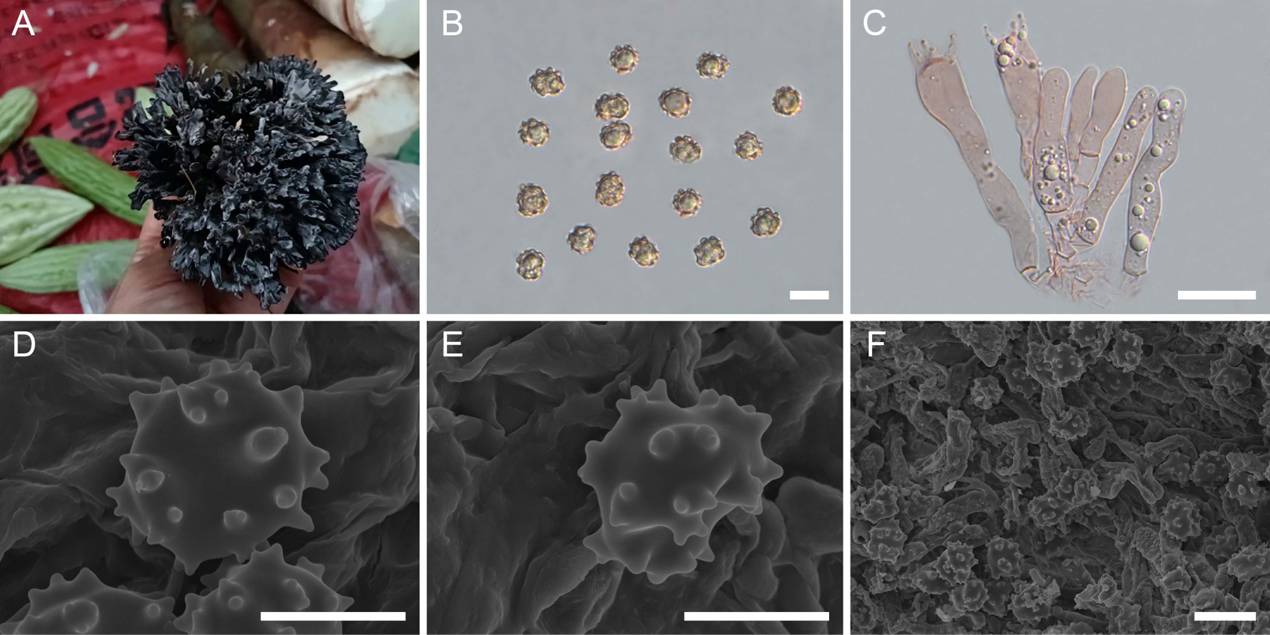 A composite image shows various stages of a fungus: A. A hand holding a black, coral-like fungus structure against a background of vegetables. B. Microscopic view of multiple round spores with spiky surfaces. C. Microscopic view of elongated spore-bearing structures with visible vesicles. D. Close-up SEM image of round spores with protrusions on a textured background. E. Another SEM close-up of a similar spore with distinct surface texture. F. SEM image showing a dense cluster of spores amidst a fibrous network.