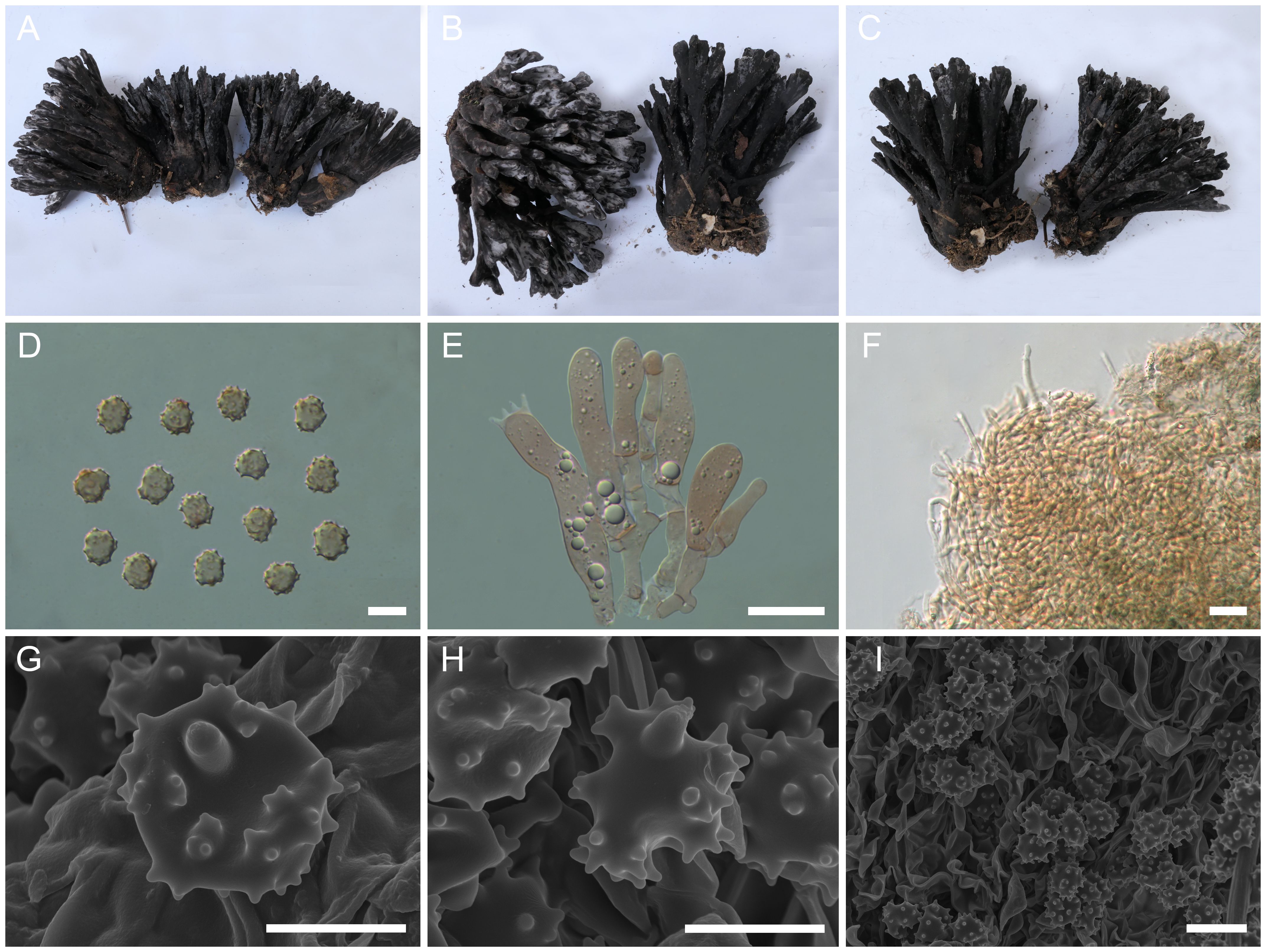 Panel A shows several clusters of dark, branch-like structures. Panel B displays a single, dark cluster with elongated formations. Panel C depicts two distinct dark, branch clusters. Panel D presents thirteen small, spherical objects arranged in a grid. Panel E illustrates several elongated, translucent structures with small spheres inside. Panel F shows densely packed elongated brown structures. Panel G captures a close-up of a textured, spherical structure. Panel H reveals multiple textured, spherical structures. Panel I displays numerous densely packed, spiky spherical formations. Each panel is marked with a white scale bar.