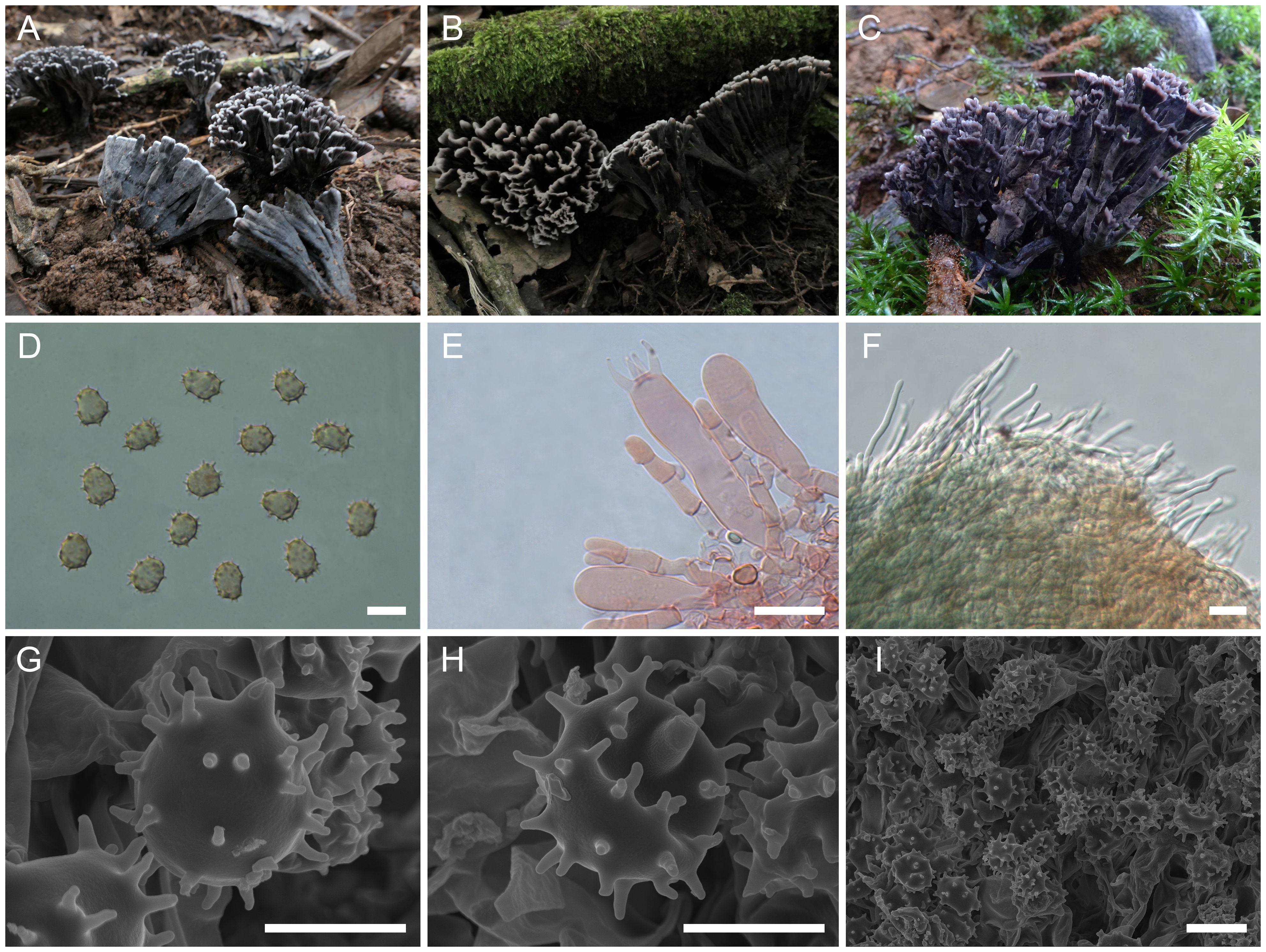 A collage of images depicting various fungal structures: (A, B) Photos of black, fan-shaped mushrooms growing on forest floors and moss. (C) Microscopic view of spiny spores. (D) Close-up of fungal tissue with elongate cells. (E) Hair-like structures on a fungal surface. (F-I) Electron microscope images showing spiny spores with different magnifications and textures.