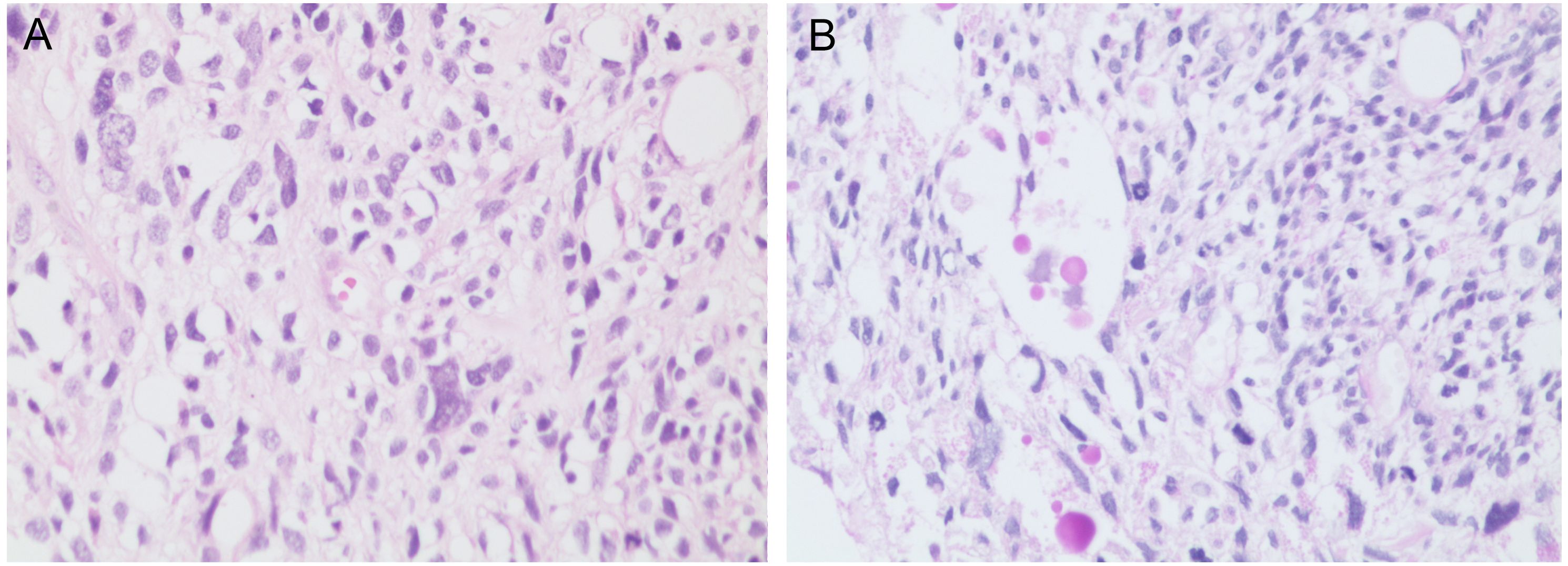 Two microscopic images labeled A and B show tissue samples stained to highlight cellular structures. Both images display varying degrees of cell density and different shapes and sizes of cell nuclei against a light background.