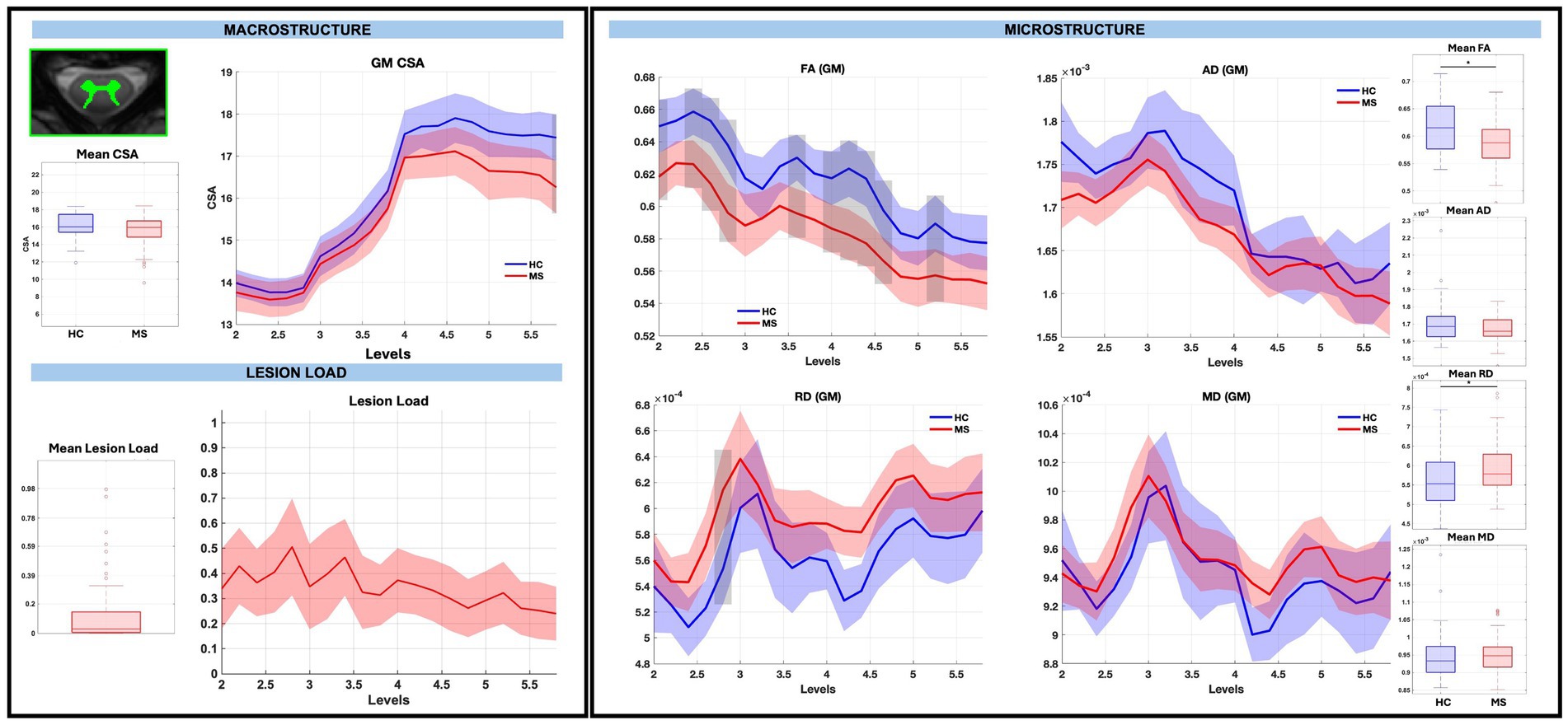 Graphs comparing healthy controls (HC) and multiple sclerosis (MS) subjects. The left side shows macrostructure data with mean cross-sectional area (CSA) and lesion load. The right side illustrates microstructure metrics: FA, AD, RD, and MD with corresponding box plots. Consistent use of blue for HC and red for MS.