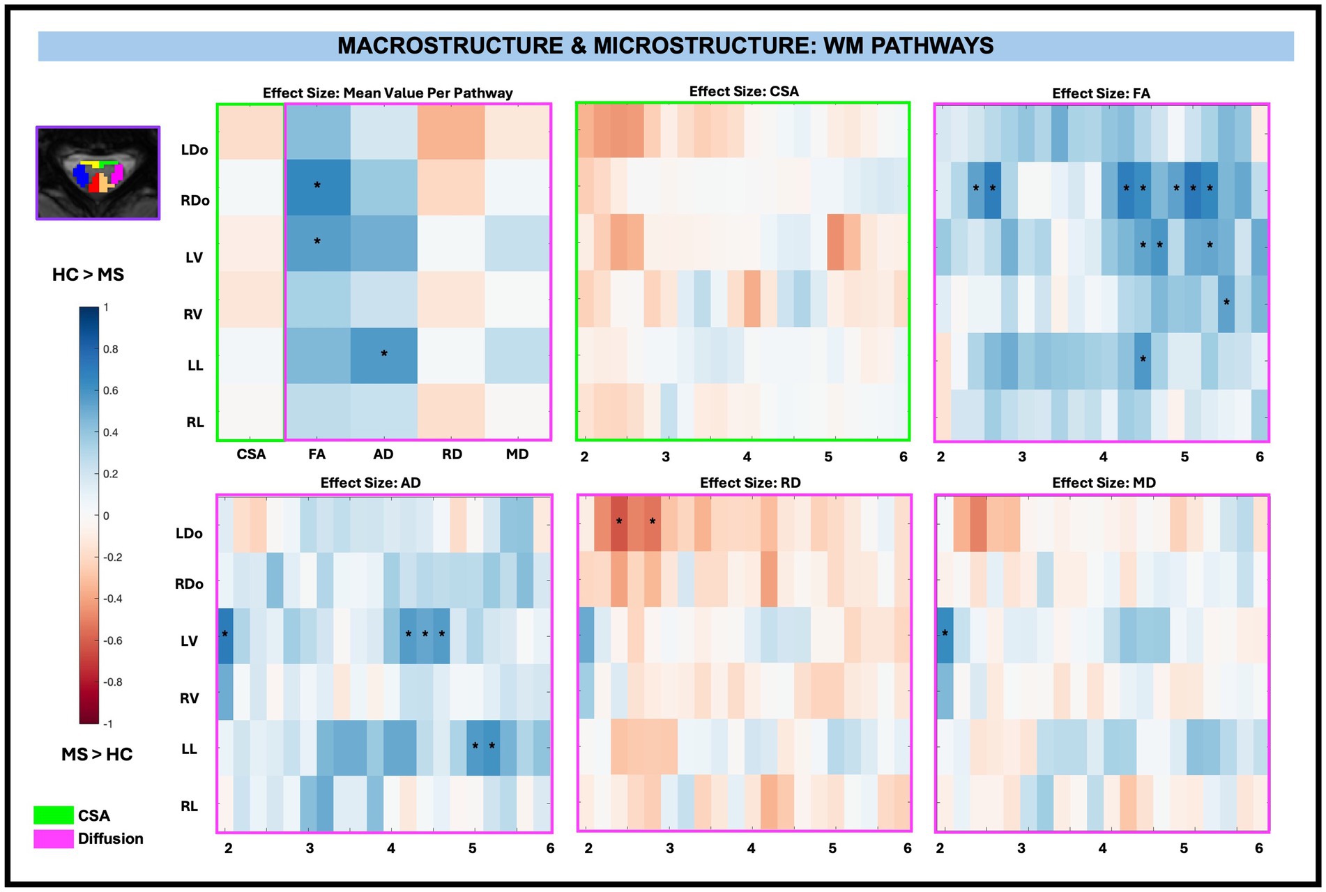 Effect-size heat maps depict spinal cord WM pathways in macrostructure and microstructure, labeled as CSA, FA, AD, RD, and MD. The top left map demonstrates mean values, with a blue to red scale. The additional five graphs depict the effect sizes listed for each measure across spinal levels C2 to C5.