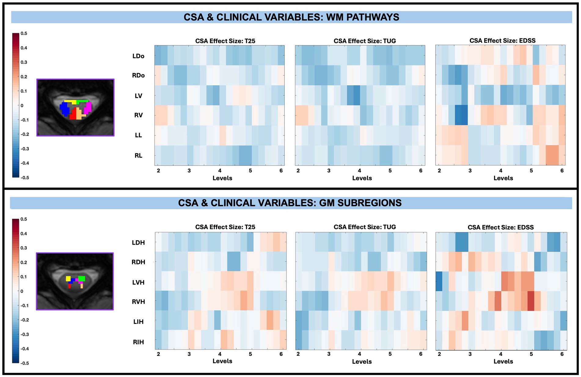 Heat maps comparing CSA effect sizes for three clinical variables: T25, TUG, and EDSS. Two axial spinal cord MRI slices WM pathways and GM subregions. A color bar on the left represents effect sizes from -0.5 to 0.5 ranging from blue (negative) to red (positive).