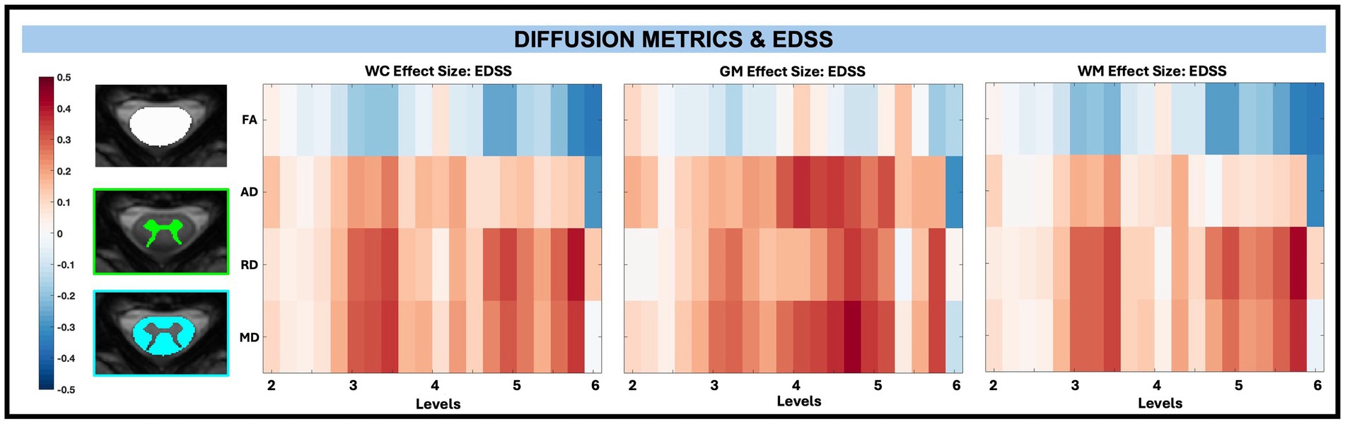 Heat maps comparing diffusion metric effect sizes with EDSS. Three axial spinal cord MRI slices show whole cord, WM, and GM. A color bar on the left represents effect sizes from -0.5 to 0.5 ranging from blue (negative) to red (positive).