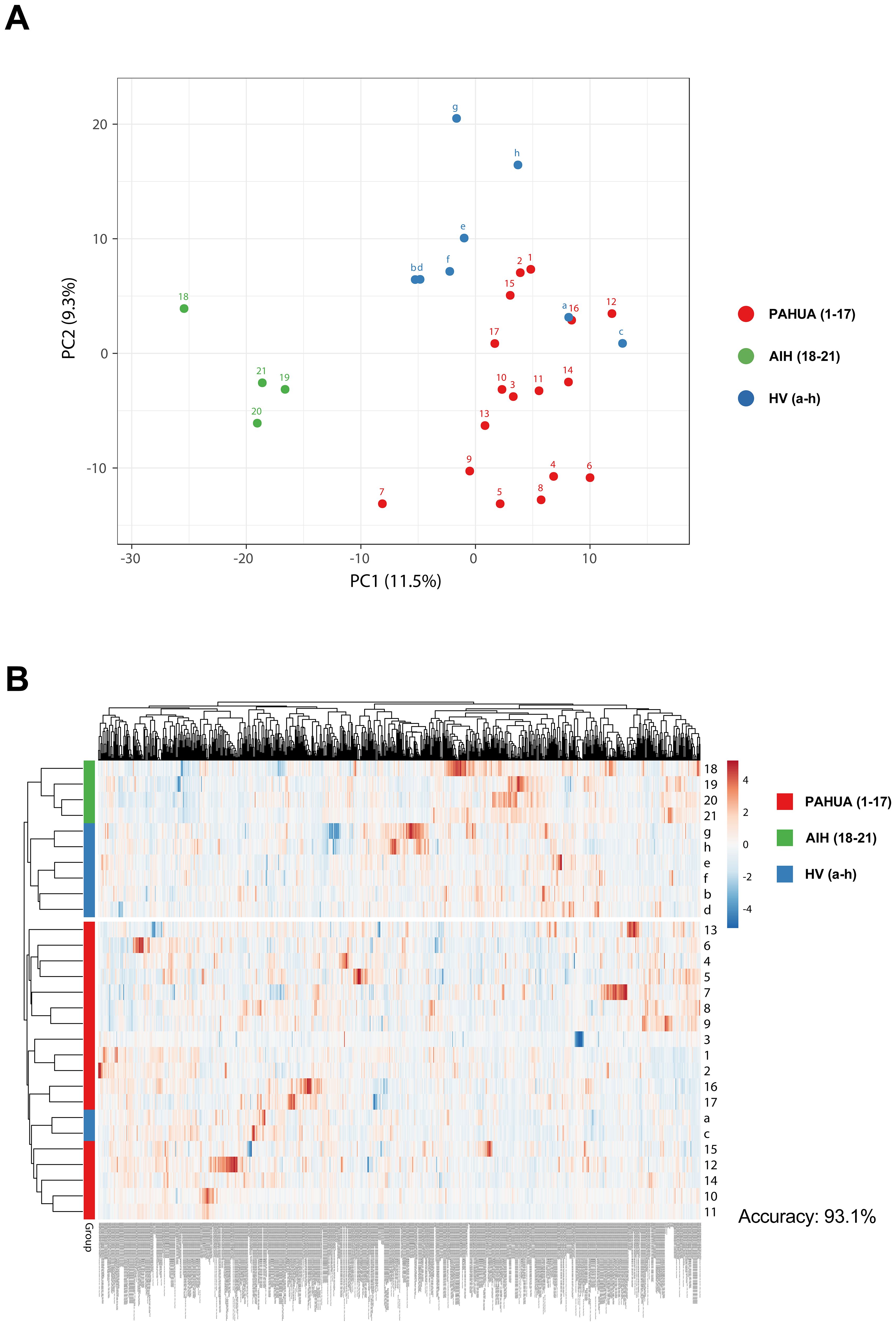 Scatter plot and heatmap analysis of three groups: PAHUA (red, 1-17), AIH (green, 18-21), and HV (blue, a-h). The scatter plot shows two principal components, PC1 and PC2, with percentage variations. The heatmap displays hierarchical clustering with gene expression levels, ranging from red (high) to blue (low), and an accuracy of 93.1 percent.