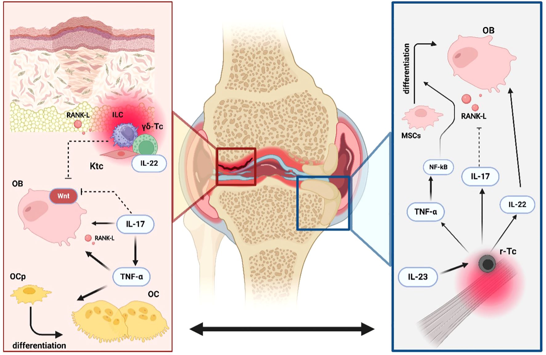 Diagram of a knee joint with two enlarged sections highlighting cellular interactions. The left panel shows interactions involving RANK-L, ILC, and γδ-Tc cells, with cytokines IL-17 and IL-22 playing roles in osteoclast activity and inflammation. The right panel depicts MSCs undergoing differentiation influenced by IL-17, IL-22, and IL-23 leading to various cell effects, including osteoblast (OB) activity and TNF-α production. Pathways involve different cytokines and signaling molecules affecting bone dynamics.