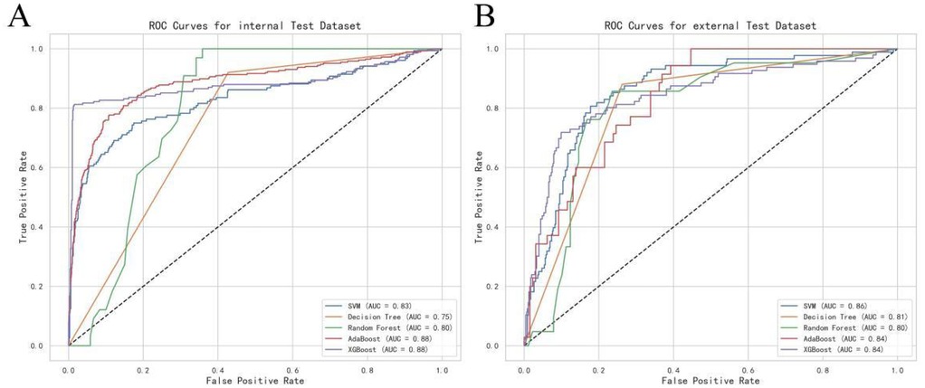 Panel A shows ROC curves for the internal test dataset, and Panel B for the external test dataset. Both panels feature lines representing models: SVM, Decision Tree, Random Forest, AdaBoost, and XGBoost, with AUC values ranging from 0.75 to 0.88. The axes are labeled