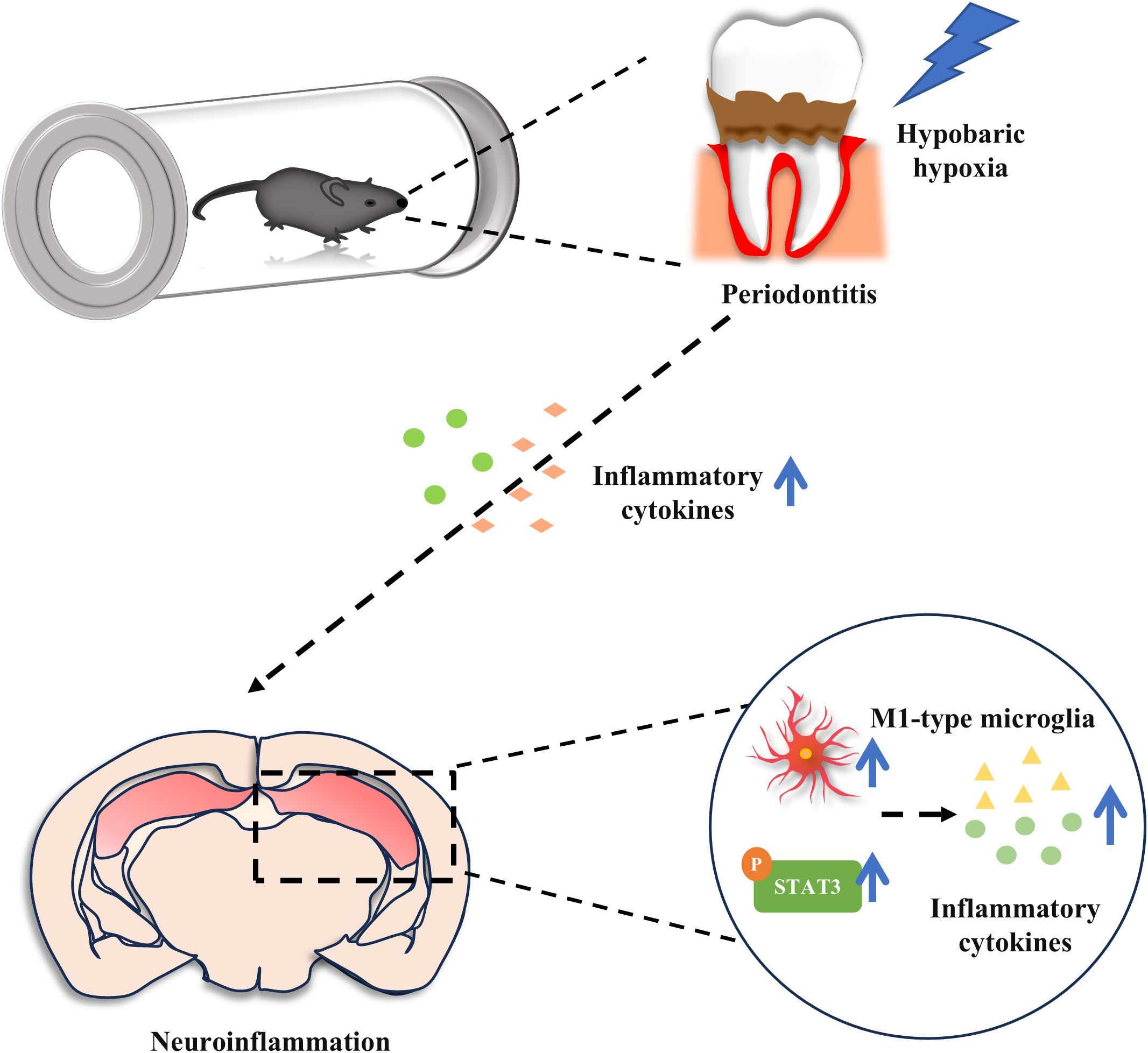 Illustration showing a sequence involving a mouse in a tube experiencing hypobaric hypoxia leading to periodontitis, depicted by an inflamed tooth. Inflammatory cytokines increase, linking to neuroinflammation in a brain cross-section. The inset highlights M1-type microglia activation, indicated by cytokines and STAT3 signaling.