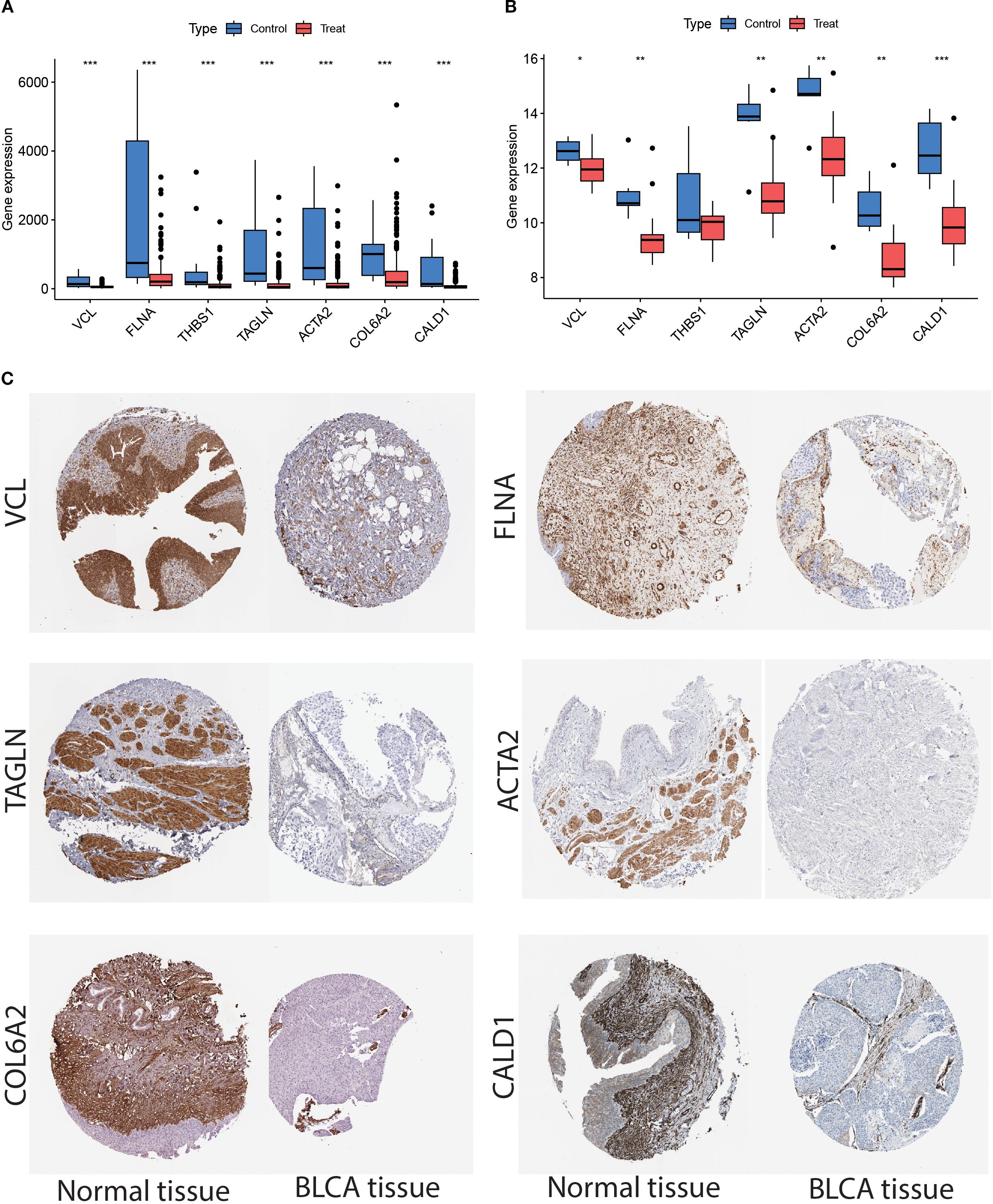 Bar graphs and box plots comparing gene expression levels of VCL, FLNA, THBS1, TAGLN, ACTA2, COL6A2, and CALD1 between control and treated groups with significant differences noted. Tissue section images below show immunohistochemical staining for these genes in normal and bladder cancer (BLCA) tissues, indicating protein localization and expression differences between the tissue types.