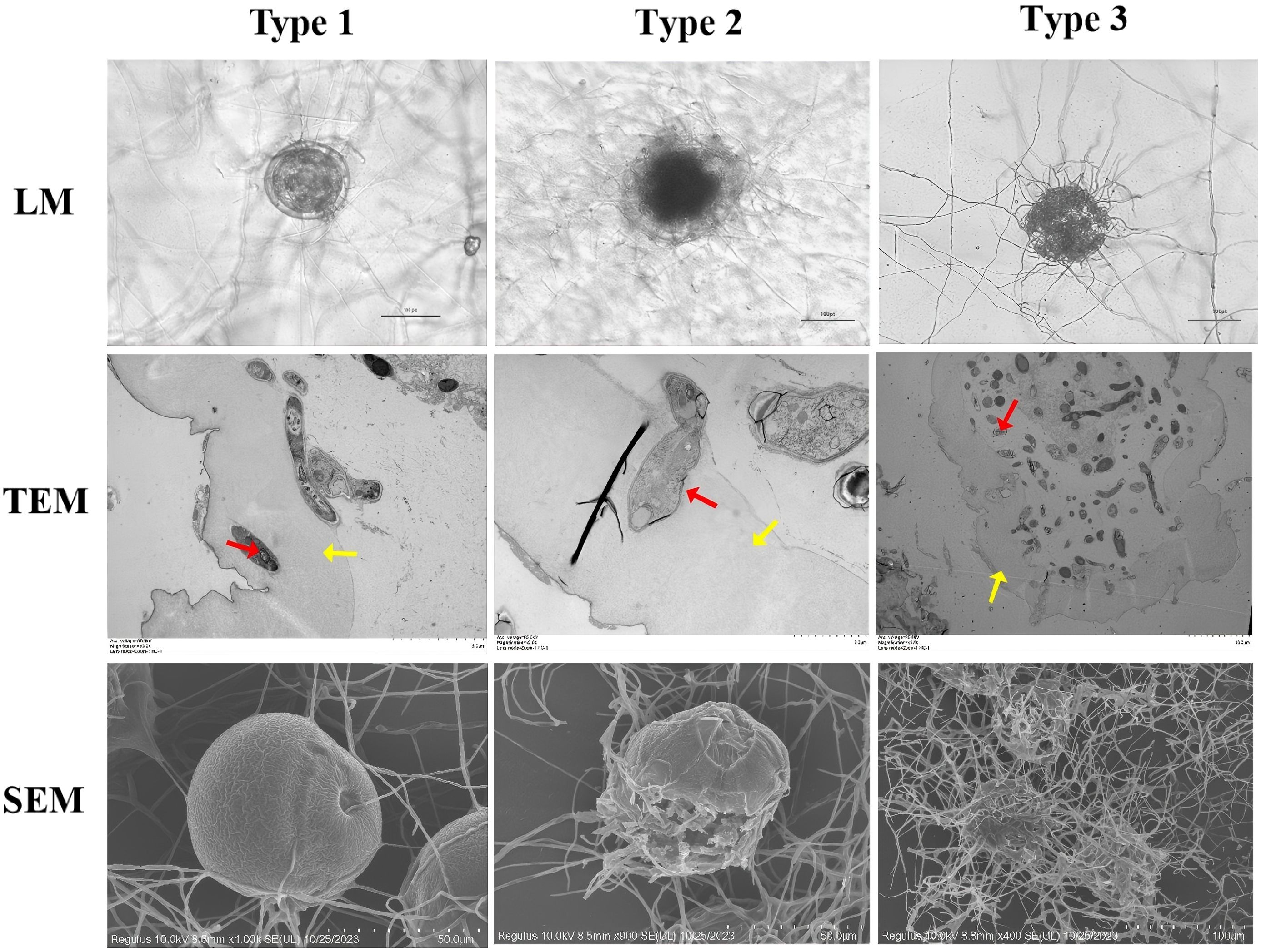 Three rows of microscopic images labeled LM, TEM, and SEM across columns Type 1, Type 2, and Type 3. LM shows general structures; TEM highlights specific details with red arrows (indicating Pochonia chlamydosporia) and yellow arrows (indicating Parascaris equorum Eggs); SEM reveals surface textures. Each type displays distinct morphological characteristics under different microscopy techniques.