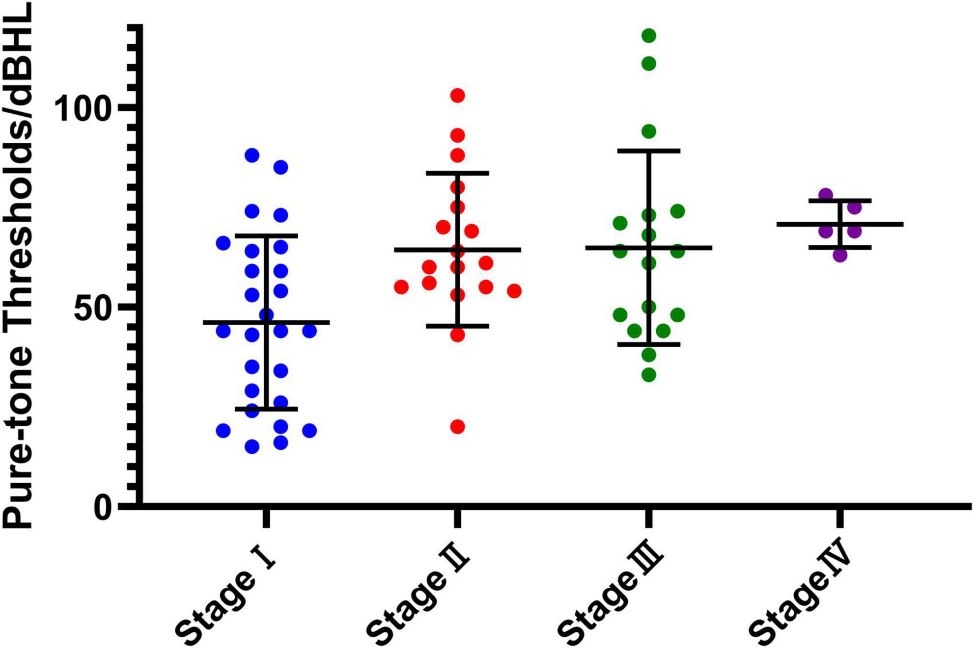 Dot plot displaying pure-tone thresholds in decibels hearing level (dBHL) across four stages. Stage I is blue, Stage II is red, Stage III is green, and Stage IV is purple. Data points and error bars illustrate variability and average thresholds in each stage.