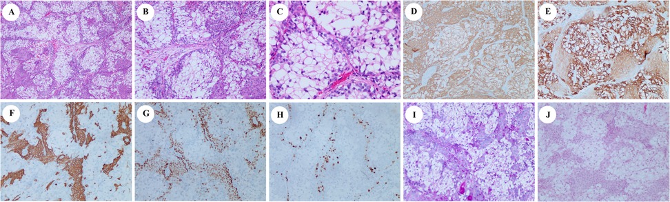 Microscopic images labeled A to J show tissue samples stained with various techniques. The top row (A-E) appears to focus on different staining patterns and tissue structures, while the bottom row (F-J) also displays diverse staining, likely to highlight different cellular components or characteristics. The images vary in staining intensity and cellular detail, suggesting different histological analyses.