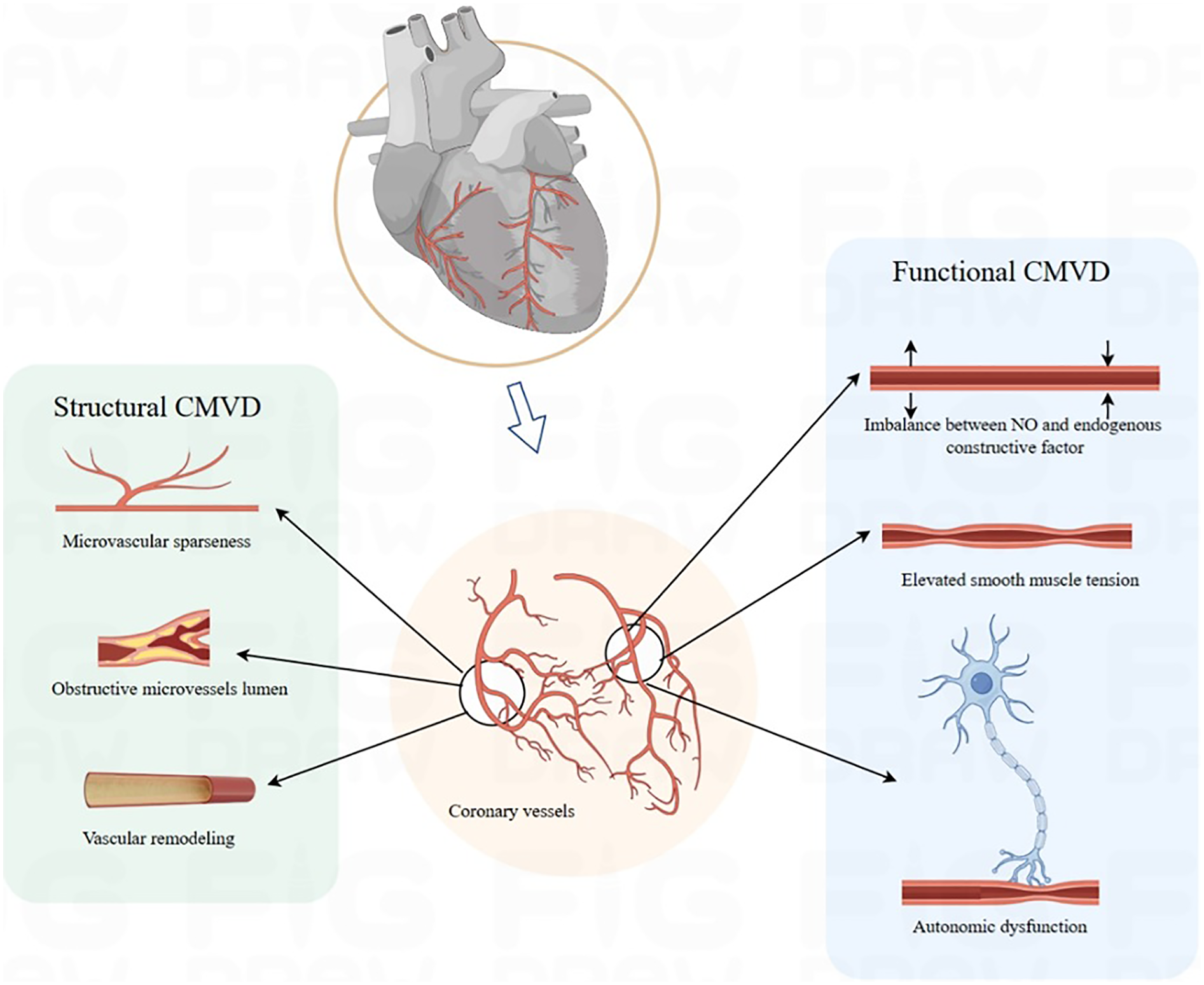 Diagram illustrating coronary microvascular dysfunction (CMVD) with sections on structural and functional aspects. Structural CMVD includes microvascular sparseness, obstructive microvessel lumen, and vascular remodeling. Functional CMVD highlights imbalance between nitric oxide and endogenous factors, elevated smooth muscle tension, and autonomic dysfunction. Central coronary vessels connect both aspects, with an image of the heart providing context.