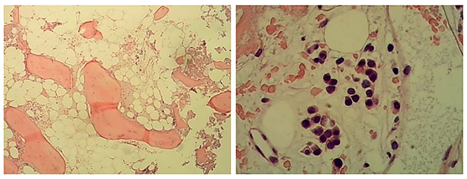 Two microscopic images display tissues at different cellular levels. The left image shows adipose tissue with large, light-colored adipocytes and pink connective tissue. The right image depicts a closer view of cellular structures, highlighting dark-stained nuclei within the tissue matrix.