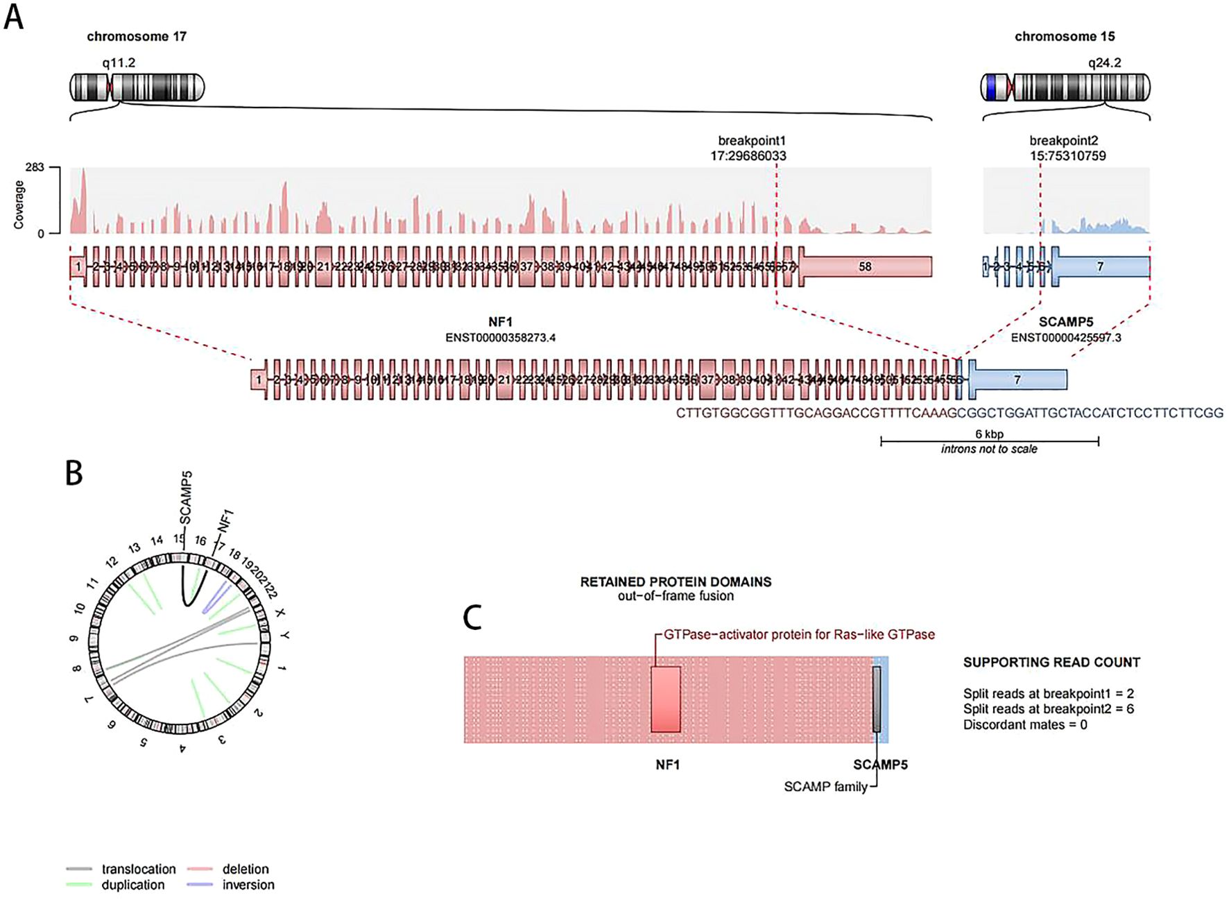 Diagram illustrating a gene fusion event between chromosome 17 and chromosome 15. It features breakpoints on NF1 and SCAMP5 genes, retained protein domain details, supporting read counts, and a circular genomic map. Translocation, deletion, duplication, and inversion are indicated with color coding.