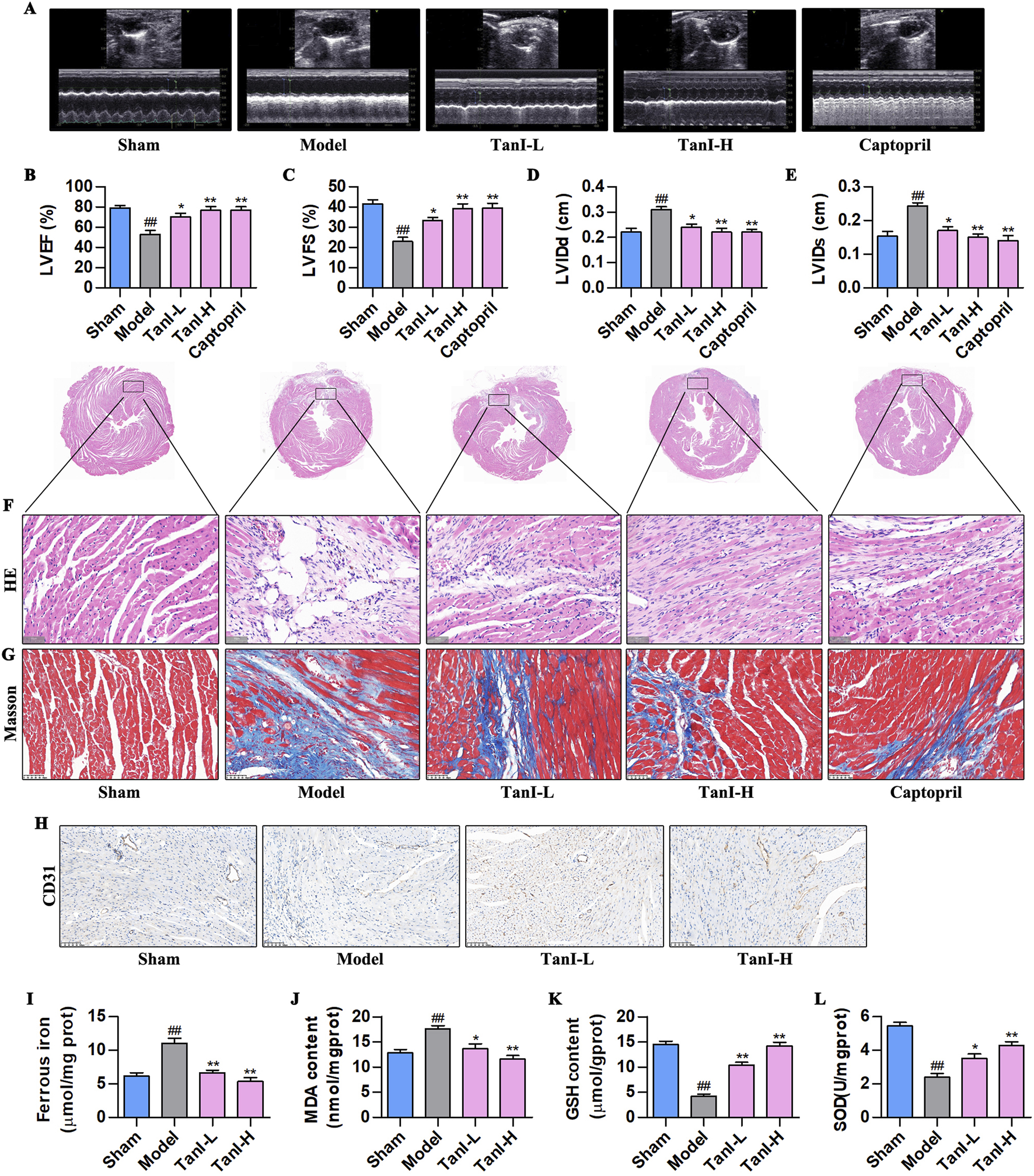 Ultrasound, histological, and biochemical comparisons between different treatments: A. Ultrasound images for Sham, Model, TanI-L, TanI-H, and Captopril groups. B-E. Graphs showing LV EF, FS, LVIDd, and LVIDs across groups. F. H&E-stained heart tissue showing structural differences. G. Masson's trichrome staining highlighting fibrosis. H. CD31 staining indicating vascular changes. I-L. Bar charts representing ferrous iron, MDA, GSH, and SOD content in each treatment group. Statistical significance is marked on the graphs.