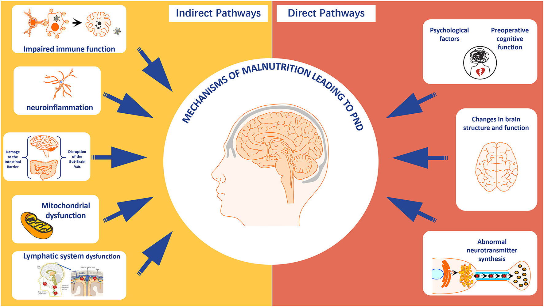Mechanisms of malnutrition leading to postoperative neurocognitive disorders (PND) are depicted. The diagram shows indirect pathways on the left, including impaired immune function, neuroinflammation, gut-brain axis disruption, mitochondrial dysfunction, and lymphatic system dysfunction. Direct pathways on the right include psychological factors, preoperative cognitive function, changes in brain structure and function, and abnormal neurotransmitter synthesis.