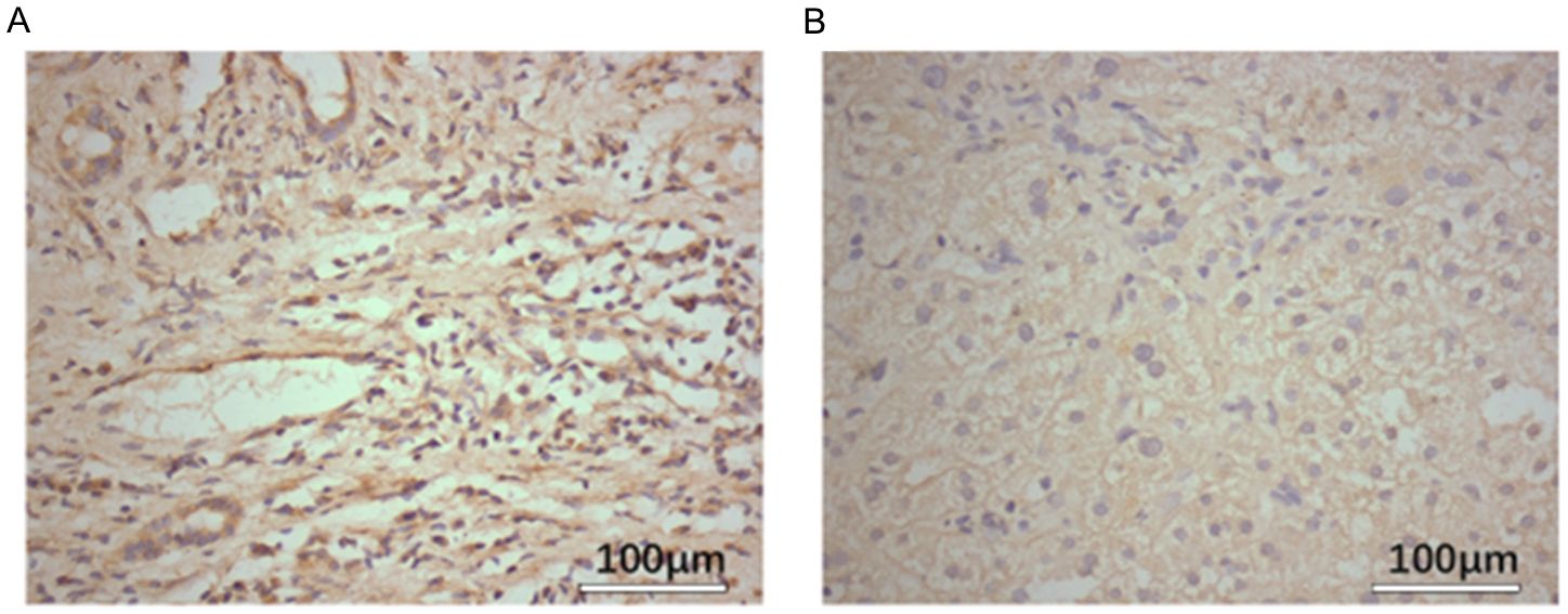 Two microscopic images labeled A and B show tissue samples. Image A features densely packed fibrous structures with numerous cell nuclei, while Image B displays a more uniform, lightly stained tissue with fewer visible cell nuclei. Both images have a scale bar indicating 100 micrometers.