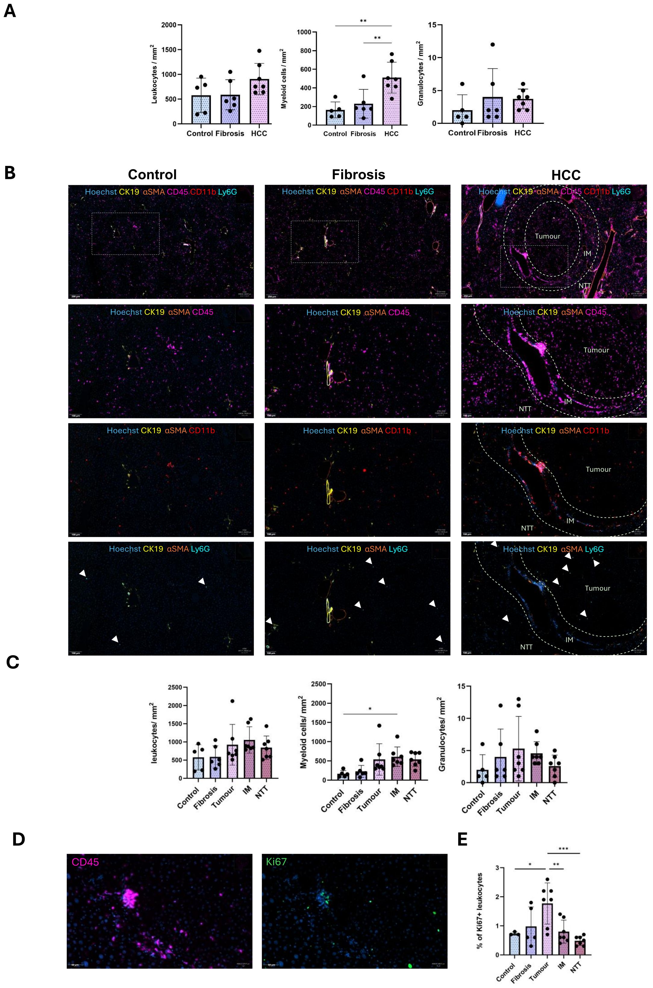 Composite image showing data from a scientific study. A: Bar graphs compare leukocyte, myeloid cell, and granulocyte counts across control, fibrosis, and HCC conditions, indicating statistical significance with asterisks. B: Immunofluorescence micrographs display liver tissue sections under control, fibrosis, and HCC conditions. Markers include Hoechst, CK19, αSMA, CD45, CD11b, and Ly6G, with annotations highlighting tumor regions. C: Bar graphs present leukocyte, myeloid cell, and granulocyte counts for different tissue types, with statistical significance marked. D: Micrographs show CD45 and Ki67 markers in tissue. E: Bar graph shows the percentage of Ki67+ leukocytes across conditions with significant differences noted.