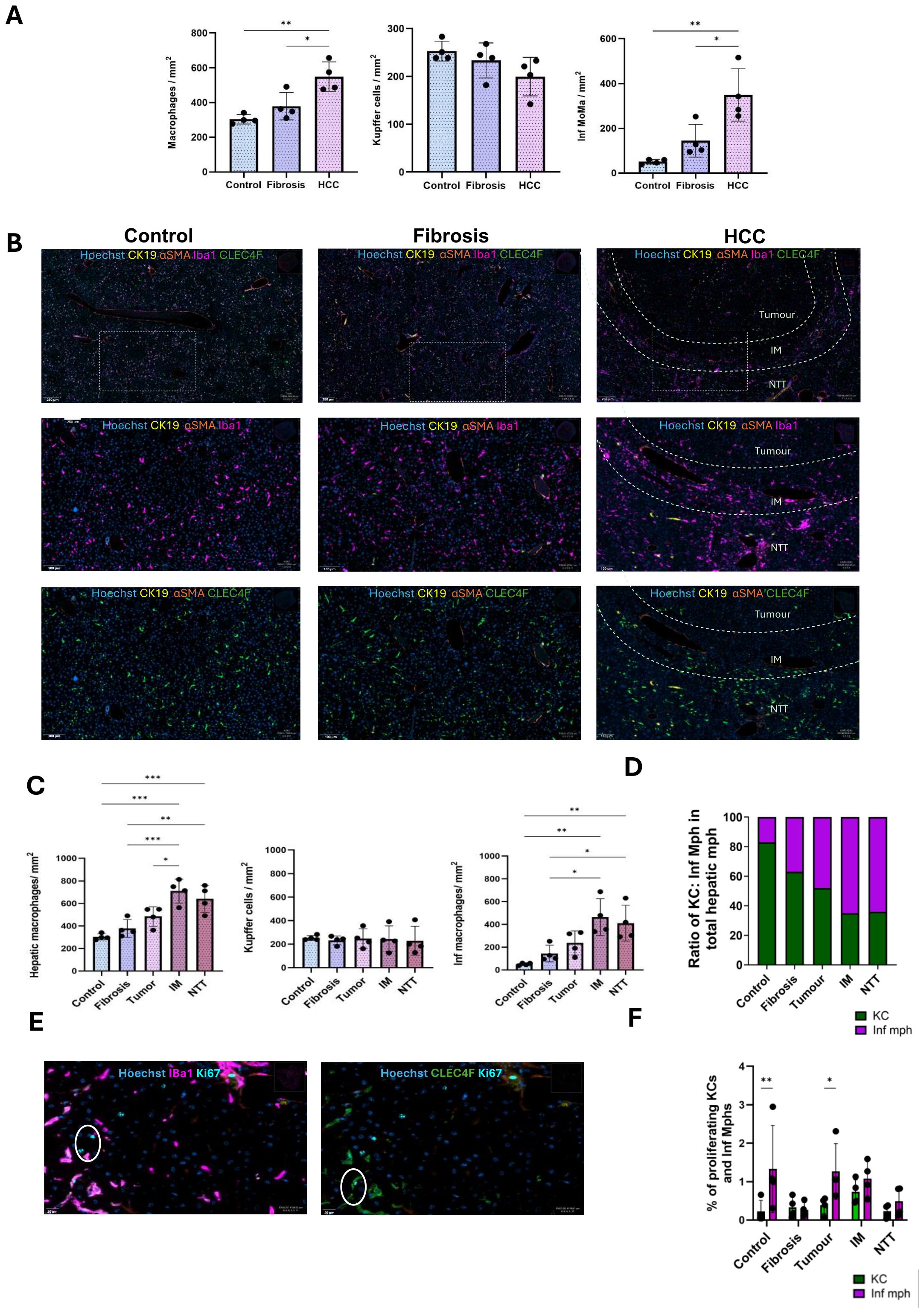 Panel A shows bar graphs comparing macrophage, Kupffer cell, and inflammatory monocyte levels across control, fibrosis, and HCC. Panel B presents immunofluorescence images of liver tissues under different conditions with markers CK19, αSMA, Iba1, and CLEC4F. Panel C features bar graphs analyzing hepatic macrophage, Kupffer cell, and inflammatory monocyte densities in various liver conditions. Panel D displays a bar graph of the KC to inflammatory macrophage ratio. Panel E includes two immunofluorescence images highlighting Ki67 in liver specimens. Panel F provides bar graphs of proliferating KC and inflammatory macrophage percentages.