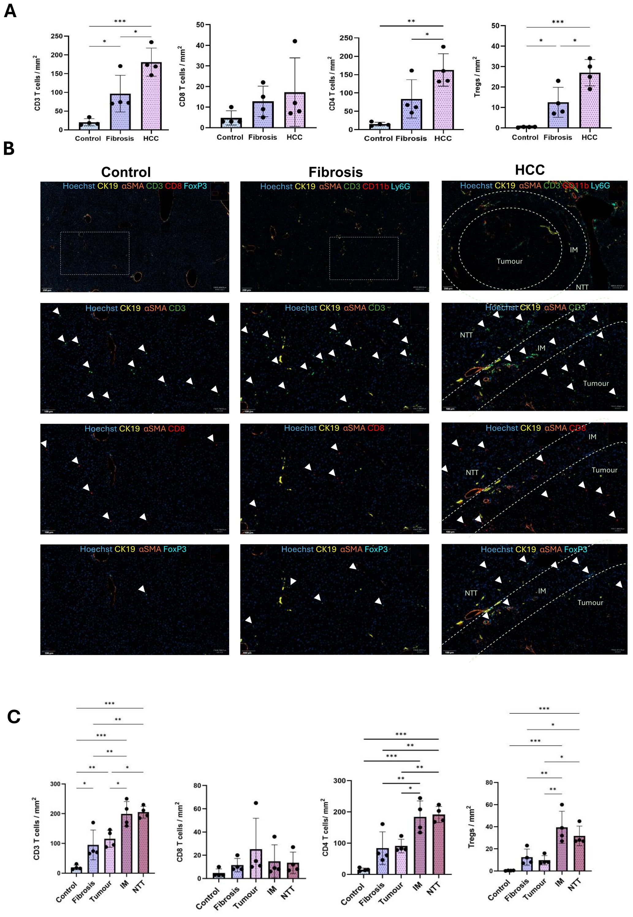 Panel A presents bar graphs comparing the density of CD3, CD8, CD4 T cells, and Tregs across control, fibrosis, and HCC groups. Panel B shows immunofluorescent images for control, fibrosis, and HCC tissues stained for Hoechst, CK19, αSMA, and immune markers, indicating immune infiltration. Panel C features bar graphs detailing CD3, CD8, CD4 T cells, and Tregs across control, fibrosis, tumor, margin tumor (MT), and non-tumor tissue (NTT), with statistical significance marked by asterisks.