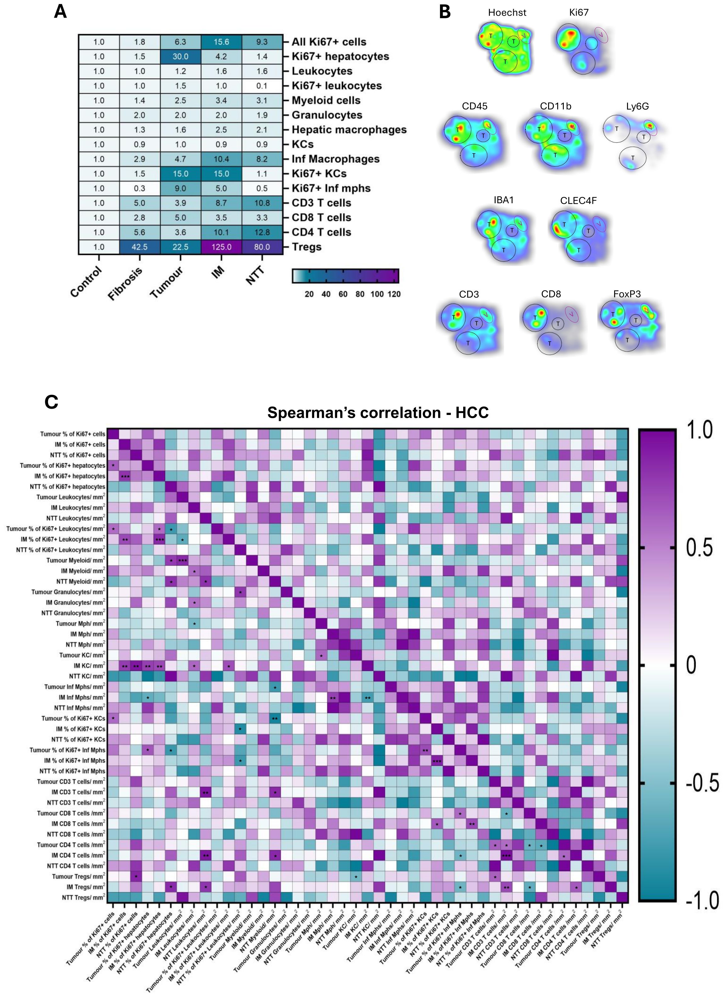 Panel A is a heat map showing cell type proportions across conditions labeled Control, Fibrosis, Tumour, IM, and NTT. Panel B shows images of different cell types with markers like Hoechst, Ki67, and CD45. Panel C is a Spearman's correlation heat map for HCC, ranging from negative one to one, denoting the correlation strength between variables.