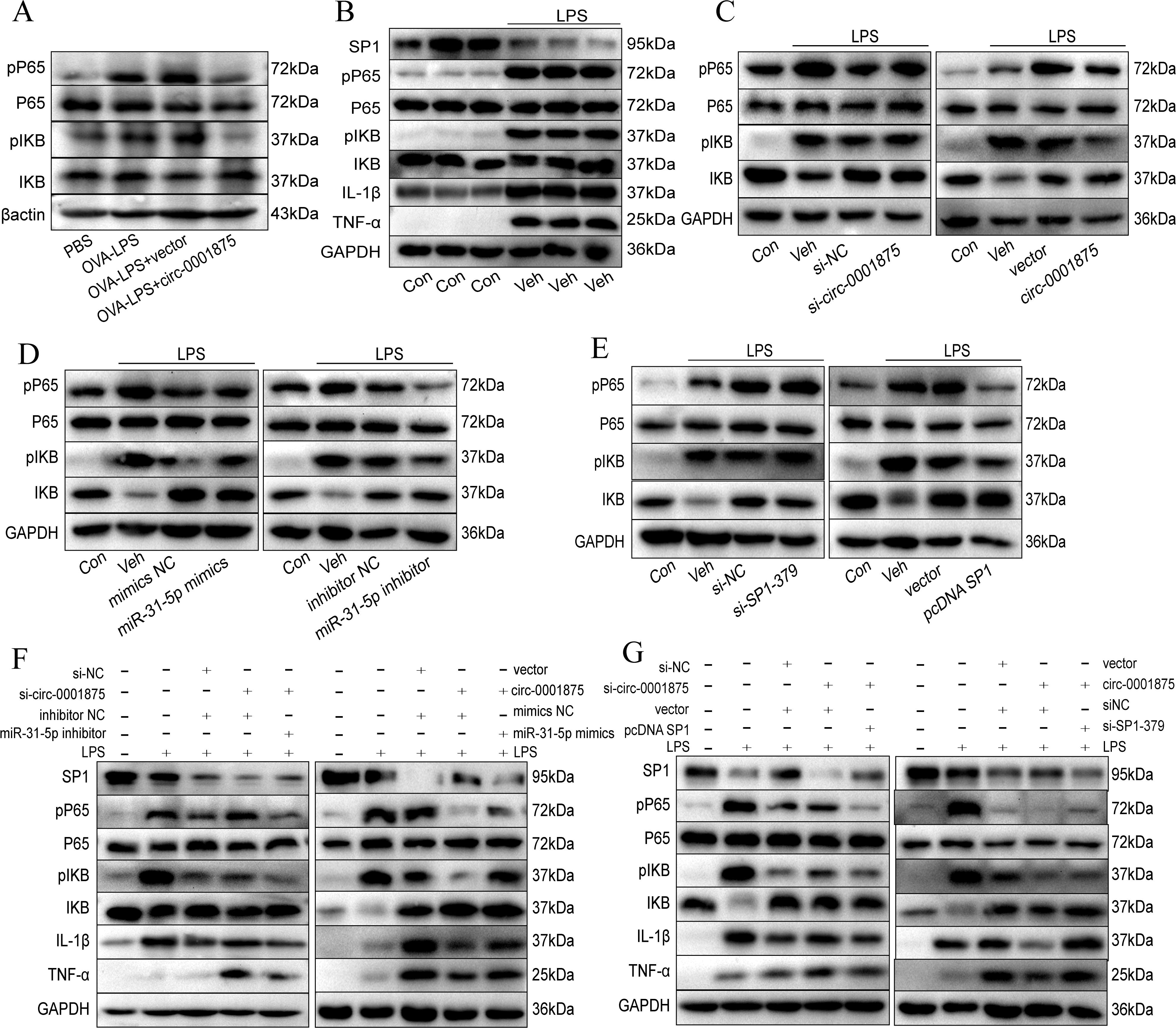 Western blot analysis showing protein expression across various experiments labeled A to G. Each panel displays different protein bands such as pP65, P65, pIκB, IκB, along with control proteins like βactin and GAPDH. Conditions include PBS, OVA+LPS, circ-0001875, and others, with size markers in kilodaltons. Different treatments and controls are compared, such as si-NC, vector, mimics NC, miR-31-5p inhibitors, si-SP1-379, and pcDNA-SP1. Bands represent protein presence and intensity across different setups, indicating experimental variations in protein expression.