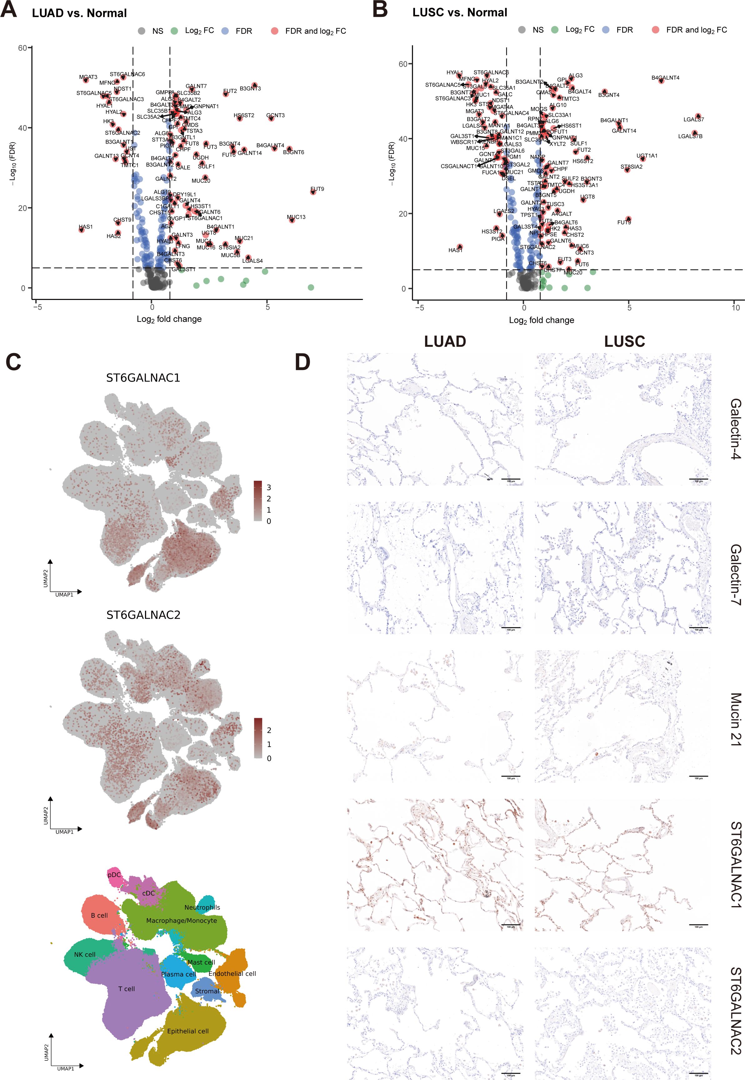 Panel A shows a volcano plot comparing gene expression in LUAD vs. normal, with significant genes highlighted. Panel B shows a similar plot for LUSC vs. normal. Panel C displays UMAP plots for ST6GALNAC1 and ST6GALNAC2 expression, with a cell-type annotation map. Panel D contains histological images of LUAD and LUSC tissue stained for Galectin-4, Galectin-7, Mucin 21, ST6GALNAC1, and ST6GALNAC2.