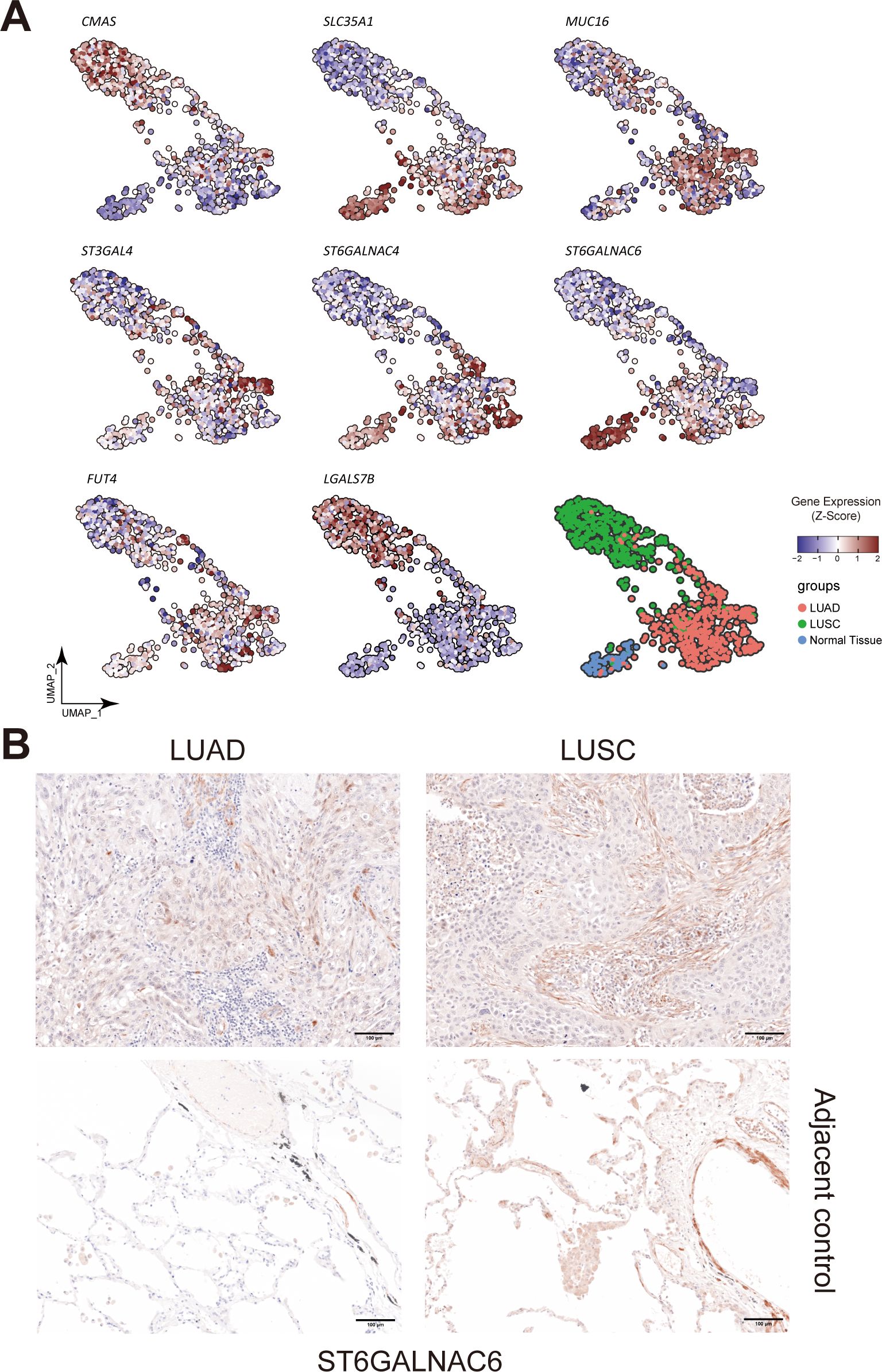 Panel A displays UMAP plots showing gene expression of CMAS, SLC35A1, MUC16, ST3GAL4, ST6GALNAC4, ST6GALNAC6, FUT4, and LGALS7B in different tissues, with color gradients indicating expression levels. Panel B shows histological images of LUAD and LUSC tissues with adjacent controls, stained for ST6GALNAC6 expression.