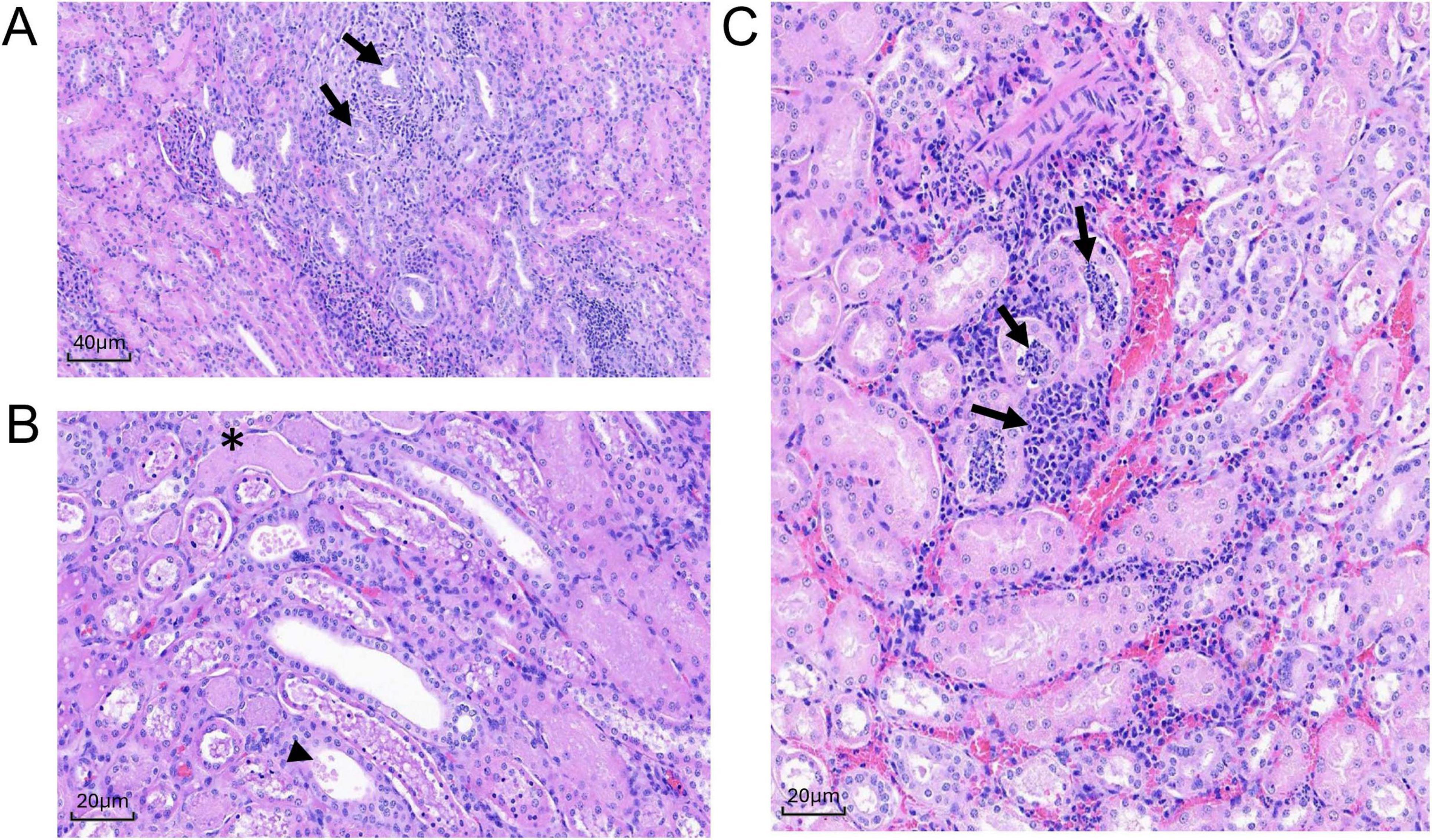 Histological slides of kidney tissue showing inflammation. Panel A displays dense cellular infiltrates marked by arrows. Panel B highlights tubular structures, with an asterisk indicating a darker region and an arrowhead showing a tubular cross-section. Panel C exhibits prominent inflammatory cell clusters marked by arrows. Each panel includes a scale bar, with Panels A and B at forty micrometers and twenty micrometers, respectively.
