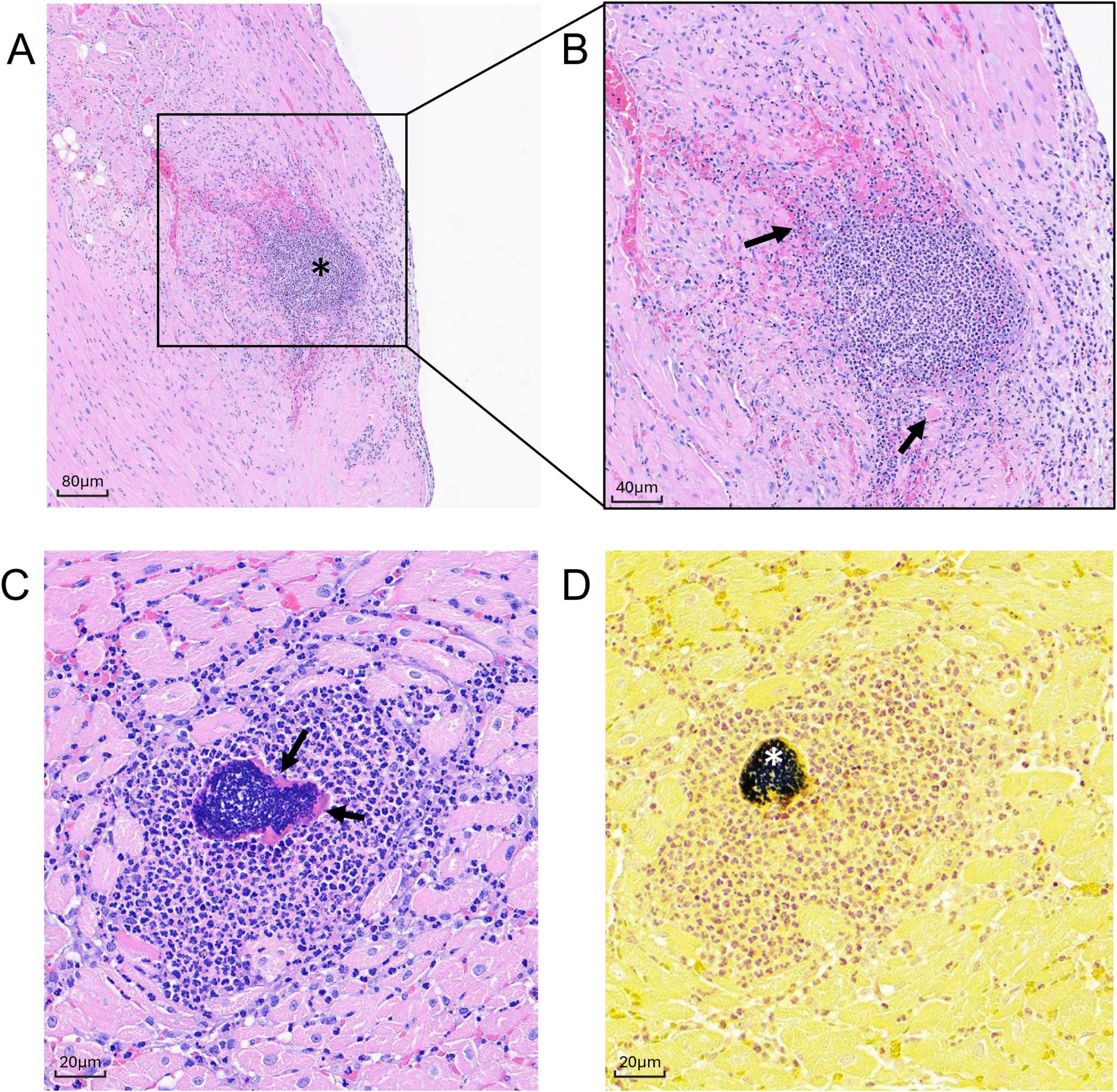 “Four microscopic images show different tissues stained to highlight cellular structures. A: A tissue section with an asterisk marking a cluster of dense cells, with a scale bar of 80 micrometers. B: A closer view of the cluster in A, with arrows indicating specific regions, scale bar 40 micrometers. C: Blue-stained tissue showing cellular detail with arrows pointing to certain cells, scale bar 20 micrometers. D: Yellow-stained tissue with an asterisk marking a distinct cluster of cells, scale bar 20 micrometers.”