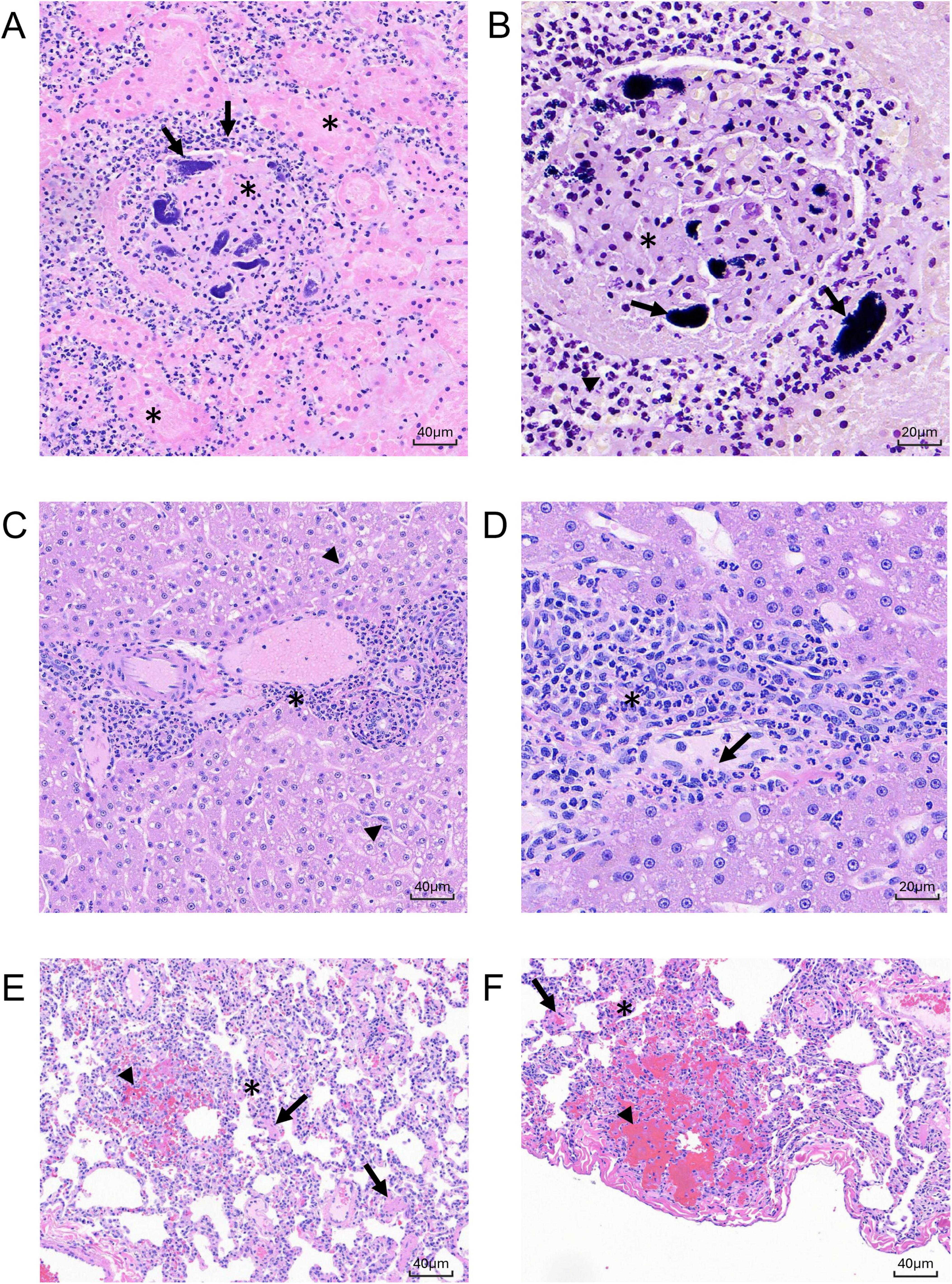 Histological slides labeled A to F showing different tissue samples stained with hematoxylin and eosin. Arrows, asterisks, and arrowheads point to specific features within each sample, possibly indicating areas of inflammation, cellular structures, or other significant histopathological details. Each panel includes a scale bar for size reference.