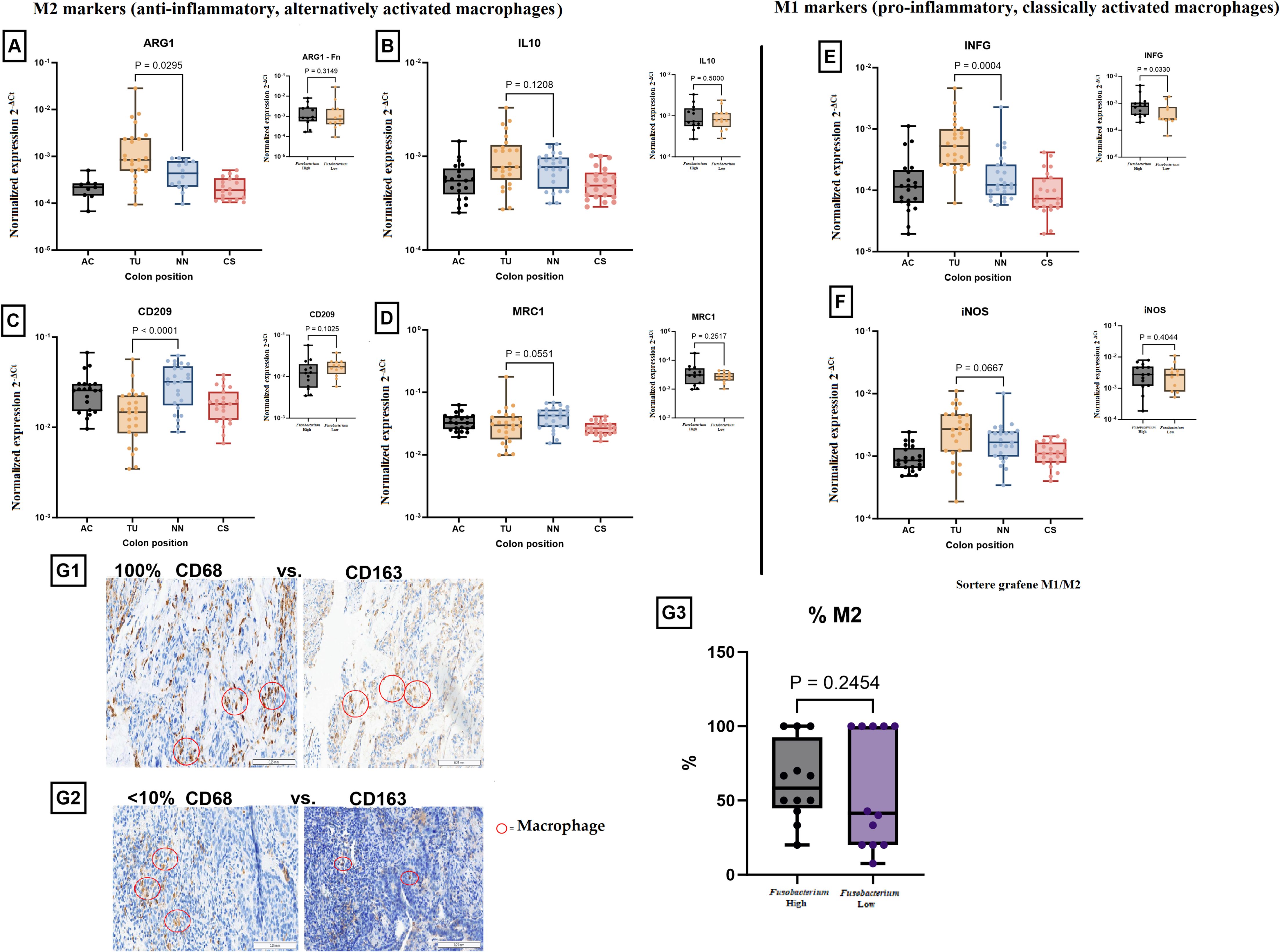 Box plots and images showing M1 and M2 macrophage marker expressions in colon positions: ascending colon (AC), tumor (TU), normal nearby tissue (NN), and distant colon site (CS). Panels A-D show M2 markers including ARG1, IL10, CD209, and MRC1. Panels E-F show M1 markers, INFγ and iNOS. G1 and G2 display macrophage presence via CD68 and CD163 staining, indicating macrophage locations. G3 shows a box plot comparing M2 percentages between high and low Fusobacterium levels. Statistical significance is indicated with P-values.