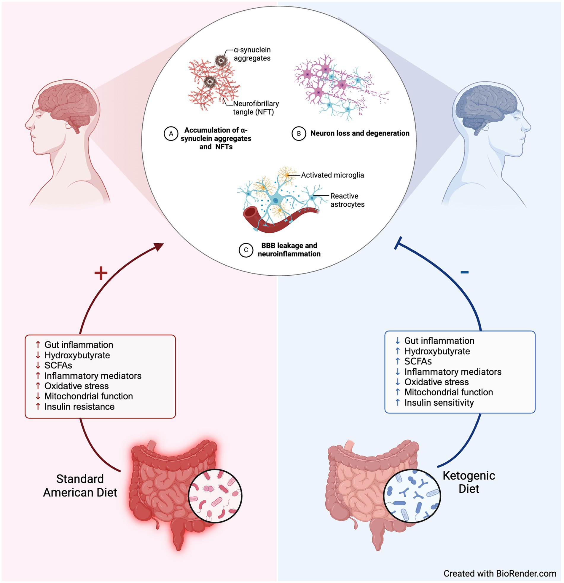 Diagram contrasting effects of Standard American Diet and Ketogenic Diet on brain and gut health. The left shows increased gut inflammation, decreased hydroxybutyrate, and negative effects linked to the Standard American Diet, leading to brain issues like synuclein aggregates and neuron degeneration. The right illustrates reduced inflammation and positive outcomes associated with the Ketogenic Diet, enhancing brain health with improved mitochondrial function and insulin sensitivity.