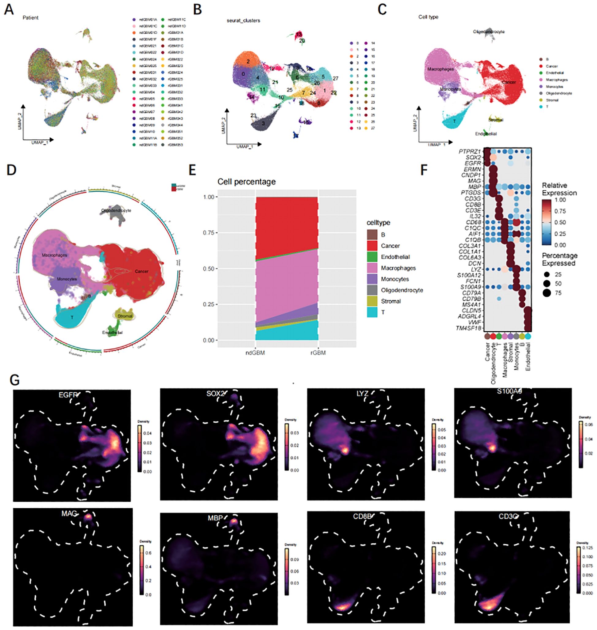 Multiple panels display various data visualizations related to cell analysis: A, B, C: UMAP plots showing cell distribution by patient, clusters, and cell types. D: Circular plot highlighting cell types like cancer and macrophages. E: Bar graph comparing cell type percentages in ndGBM and rGBM. F: Dot plot indicating relative gene expression across cell types. G: Density plots for genes EGFR, SOX2, LYZ, S100A4, MAG, MBP, CD68, CD39, with color scales indicating expression levels.