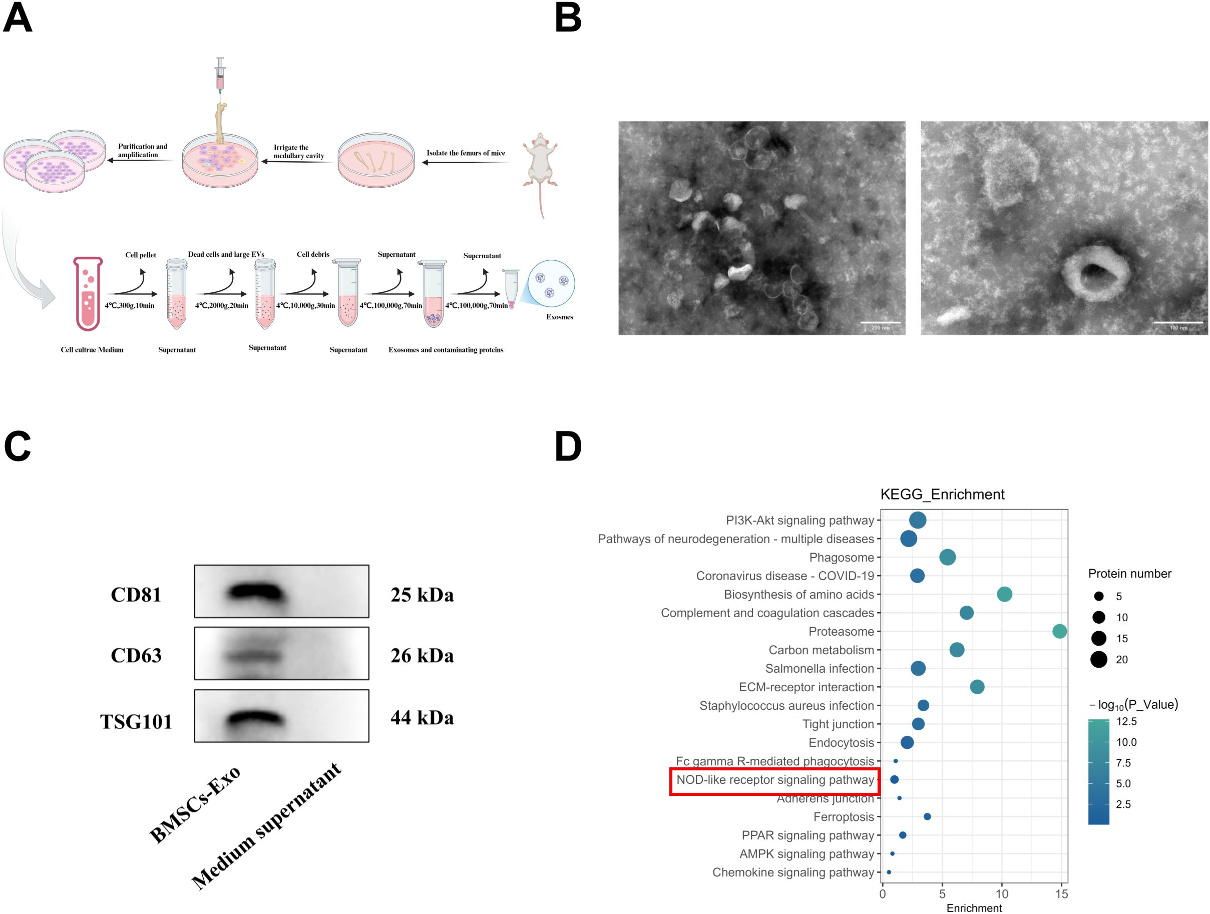Diagram illustrating exosome extraction from BMSCs, process steps, and equipment. Transmission electron microscope images of exosomes. Western blot showing proteins CD81, CD63, TSG101. KEGG enrichment chart displaying signaling pathways, with NOD-like receptor pathway highlighted.