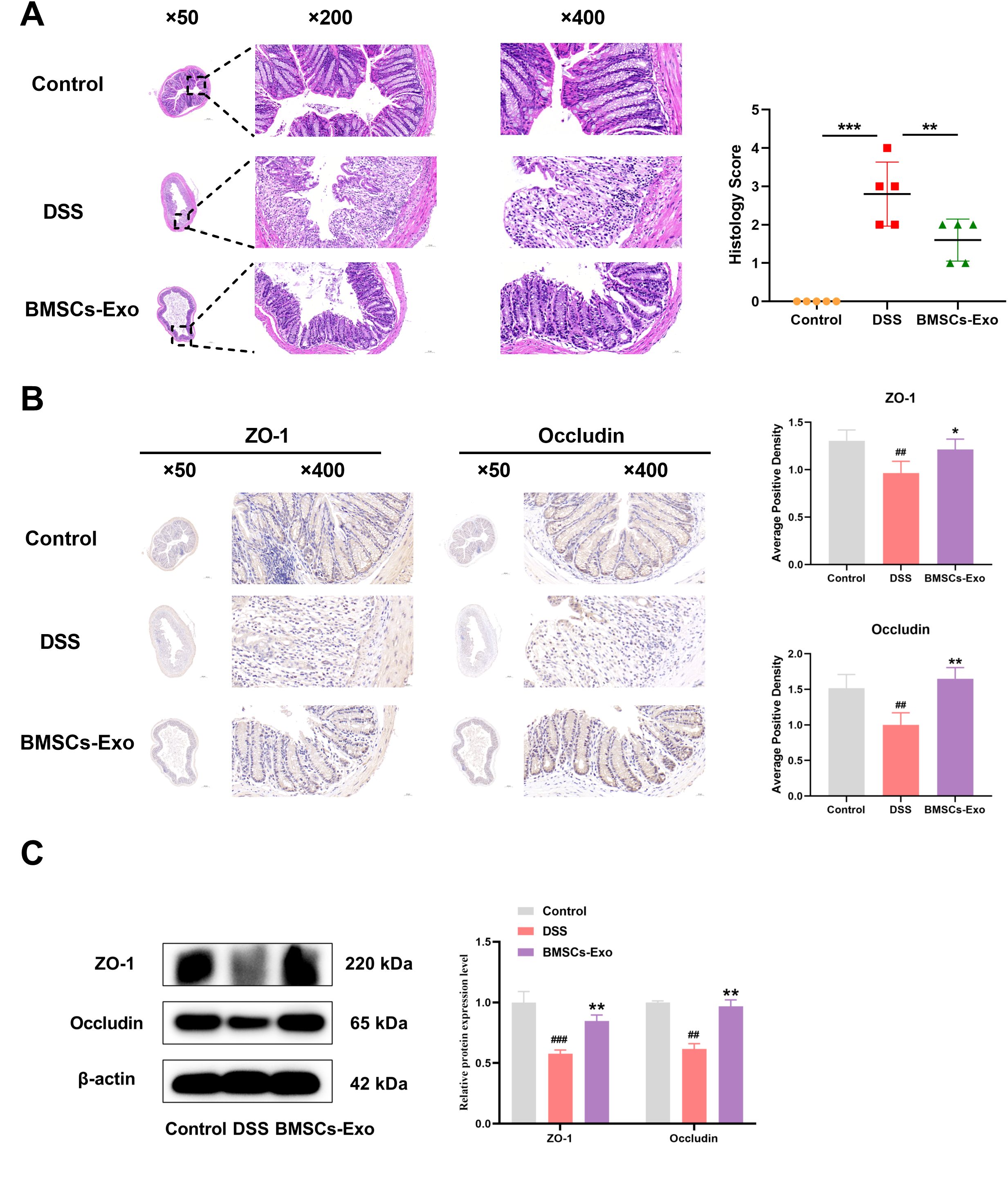Panel A shows histological images of colon tissue at different magnifications (x50, x200, x400) for Control, DSS, and BMSCs-Exo groups, with a bar graph comparing histology scores. Panel B presents ZO-1 and Occludin staining at x50 and x400 magnifications for the same groups, alongside bar graphs for average positive density. Panel C includes Western blot results for ZO-1, Occludin, and β-actin, with a bar graph showing relative protein expression levels for Control, DSS, and BMSCs-Exo groups.